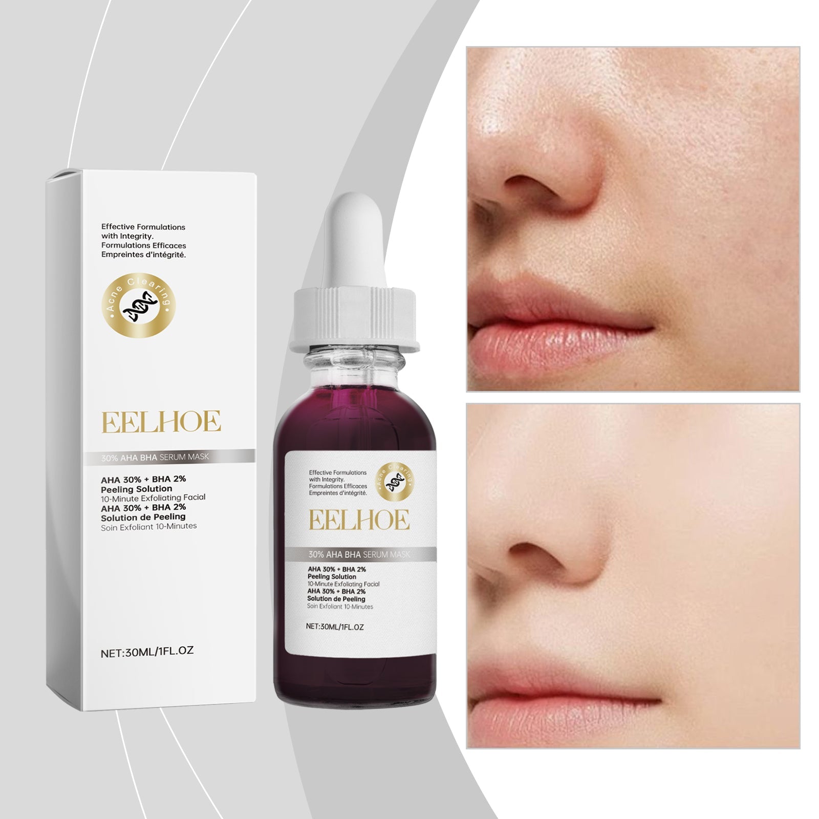30% Fruit Acid Salicylic Acid Essence Mask, Gentle Facial Care, Clear, Hydrate, Brighten Skin ,30ml