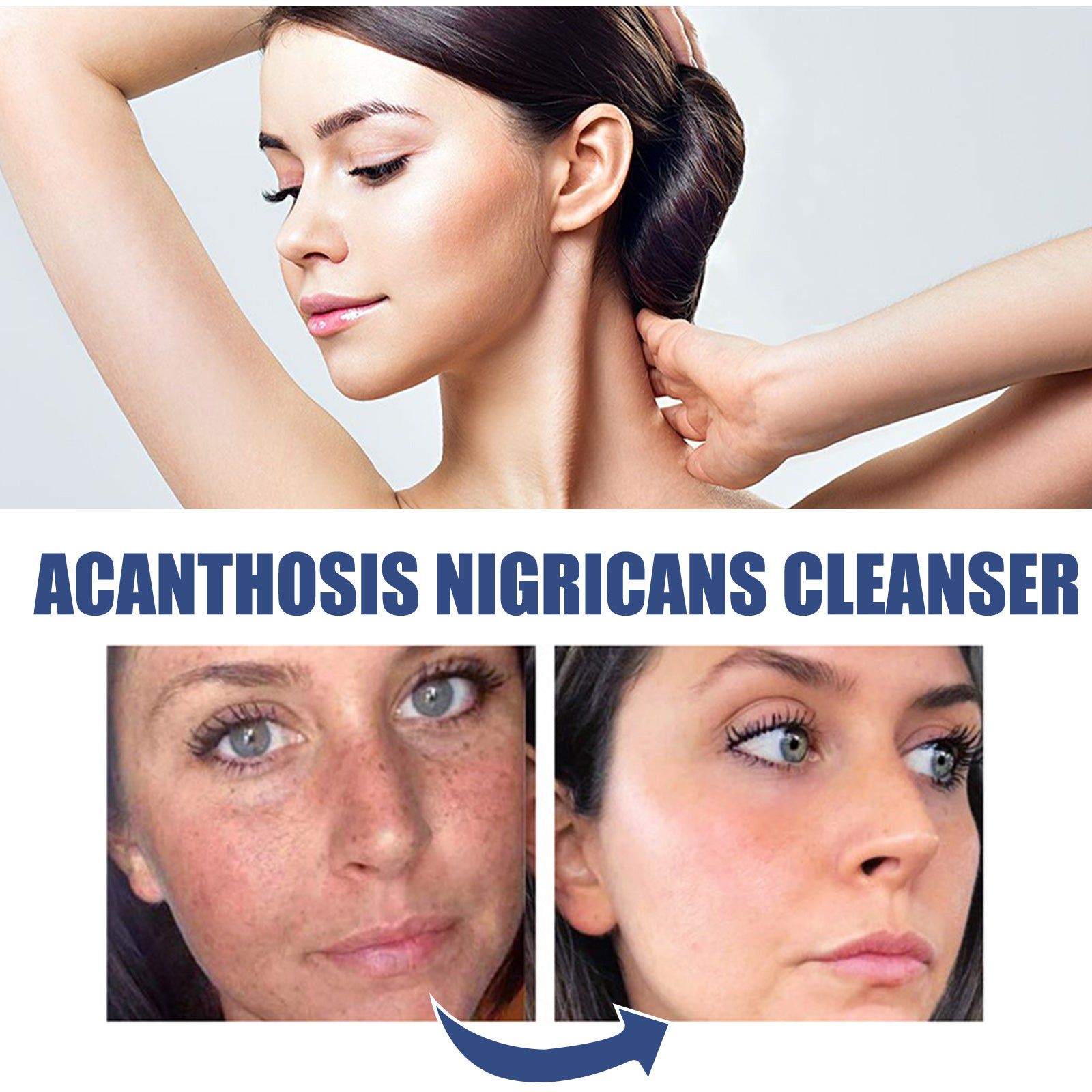 Black Acanthoderm Face Cleanser, Brighten Dark Spots, Oil Control, Moisturizing ,50ml