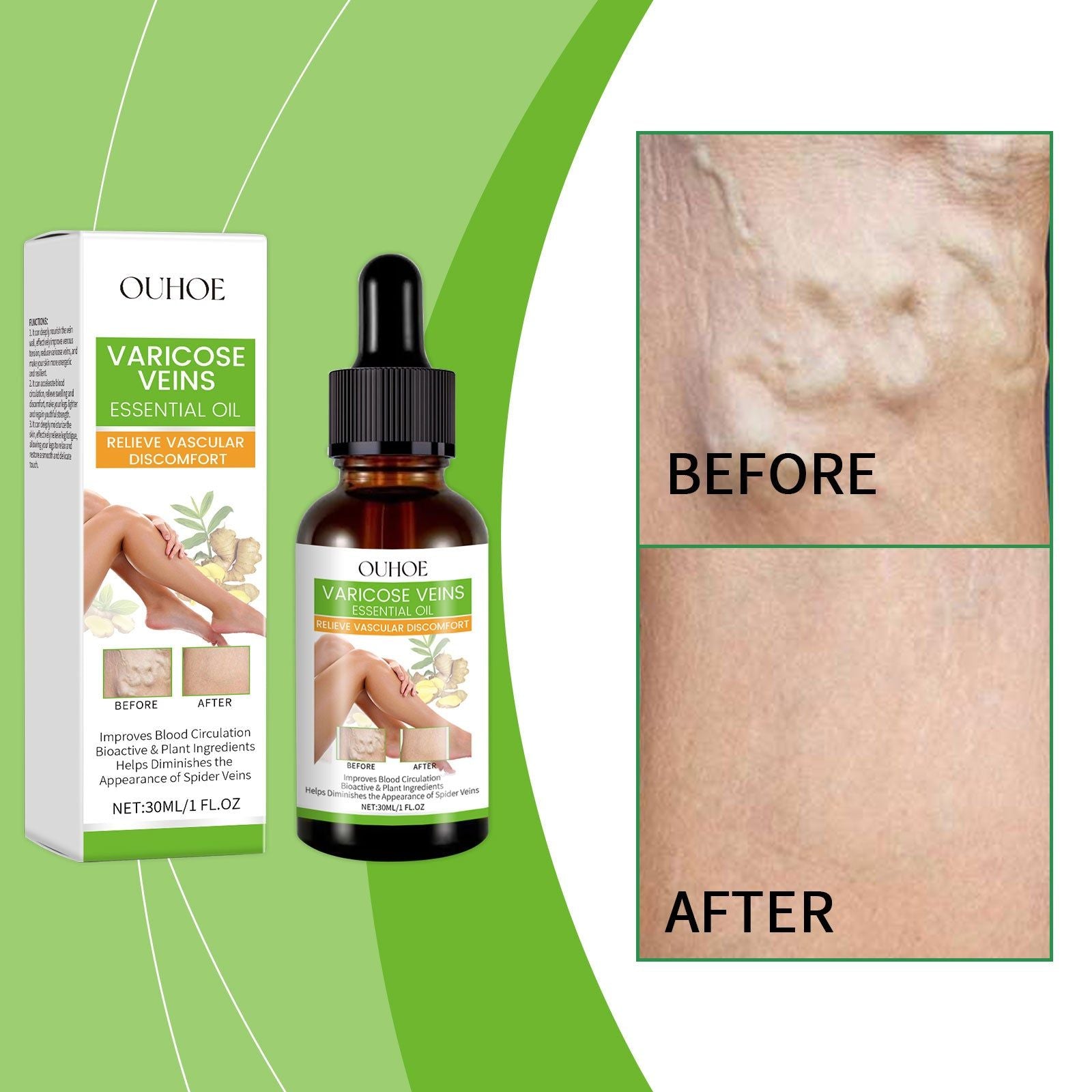 Body Care Leg Treatment with Essential Oils, Moisturizing, Soothes Varicose Veins ,30ml