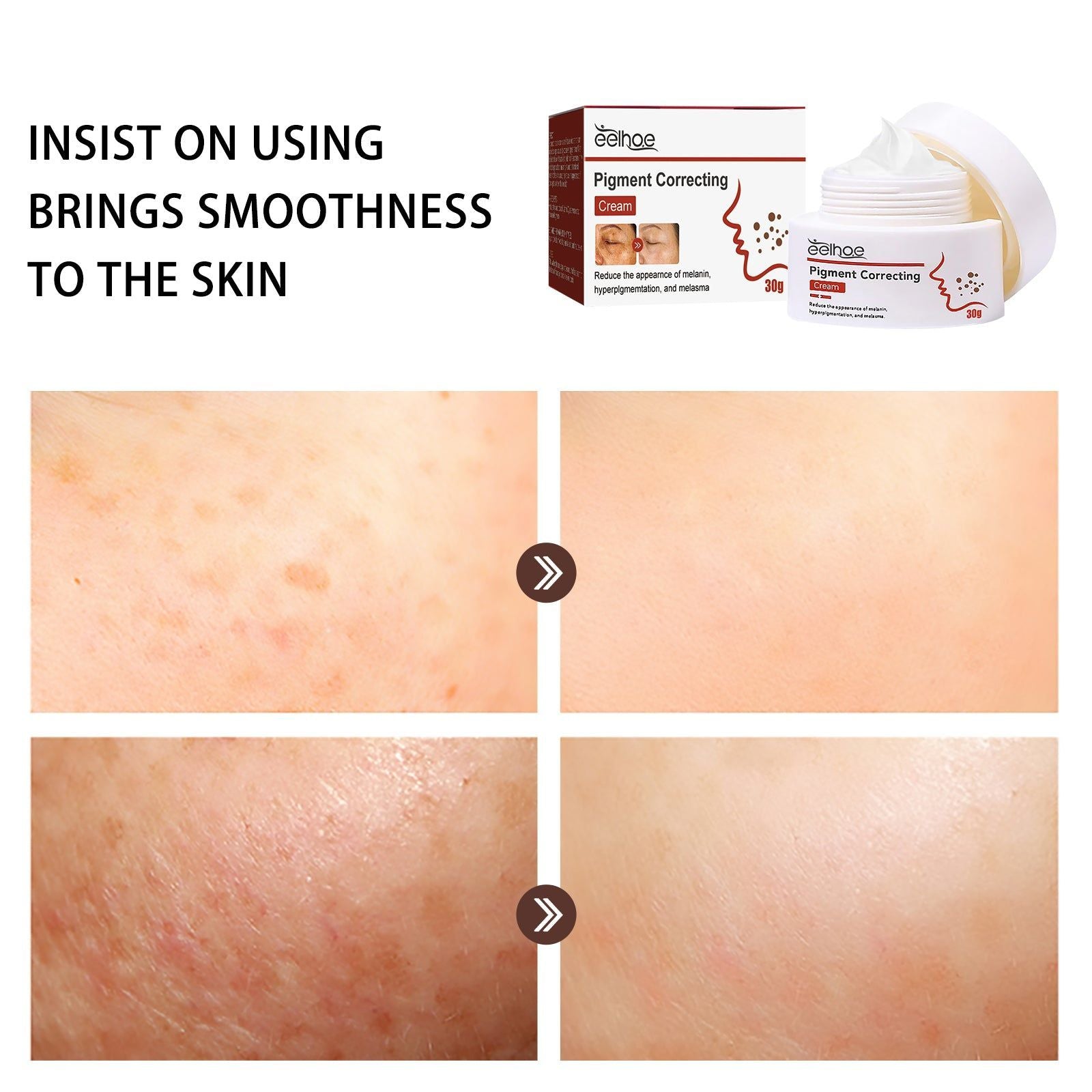 Brighten Skin Fade Dark Spots Melasma Cream, Hydrating, Gentle, Daily Care ,30g