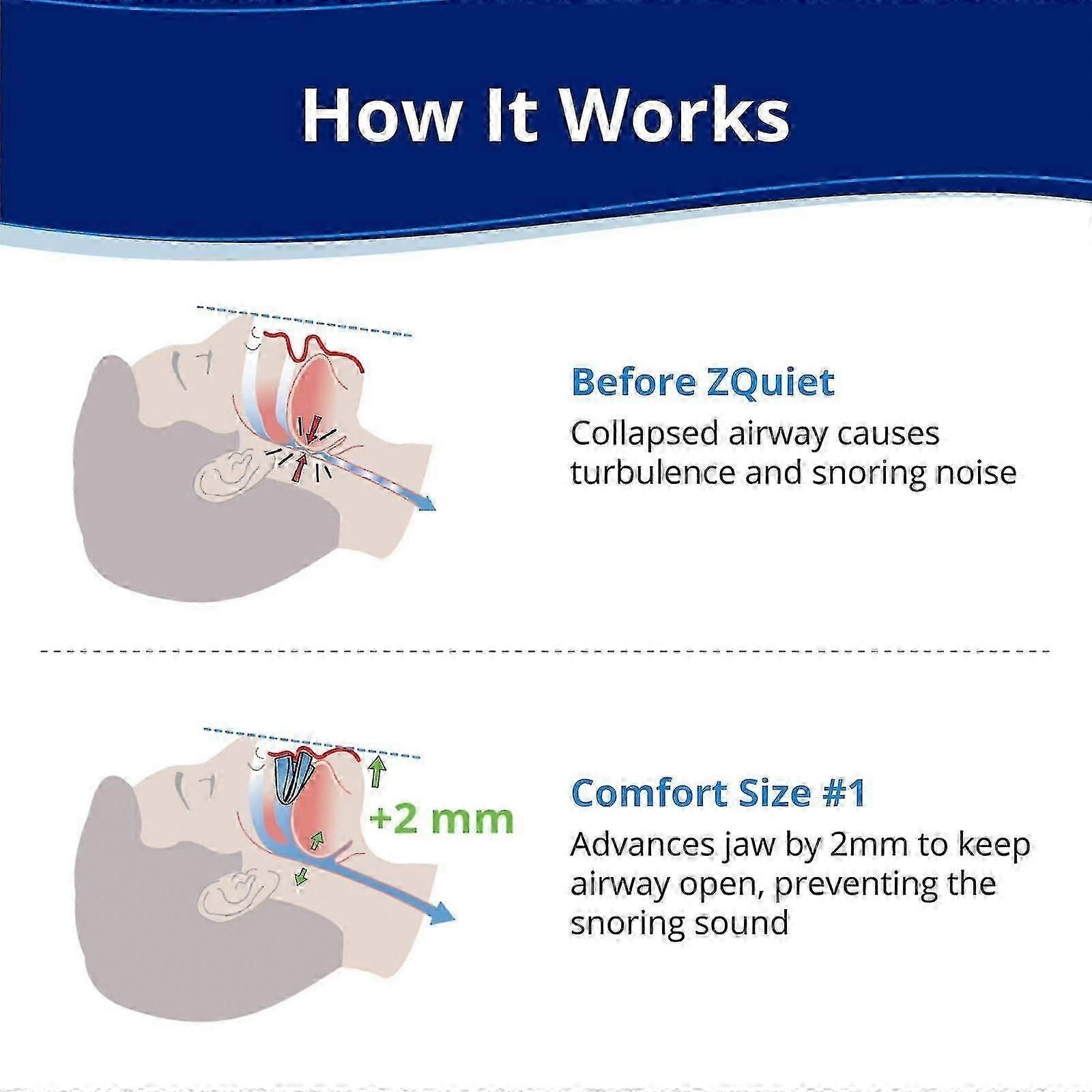 Anti-Snoring Mouthpiece Comfort Size 1 Single Refill Blue Bpa-Free