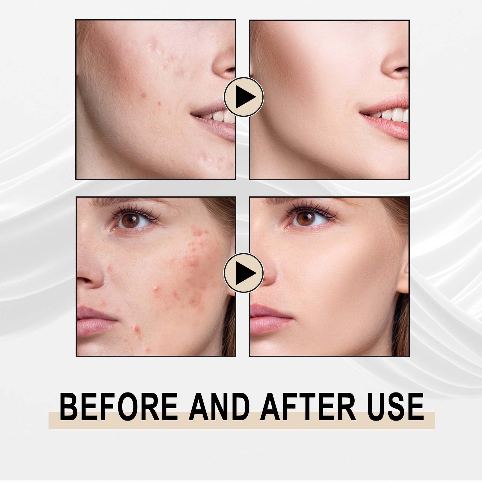 Deep Cleanse Gentle Exfoliation Lactose Solution for Blackheads Pore Shrinking ,30ml