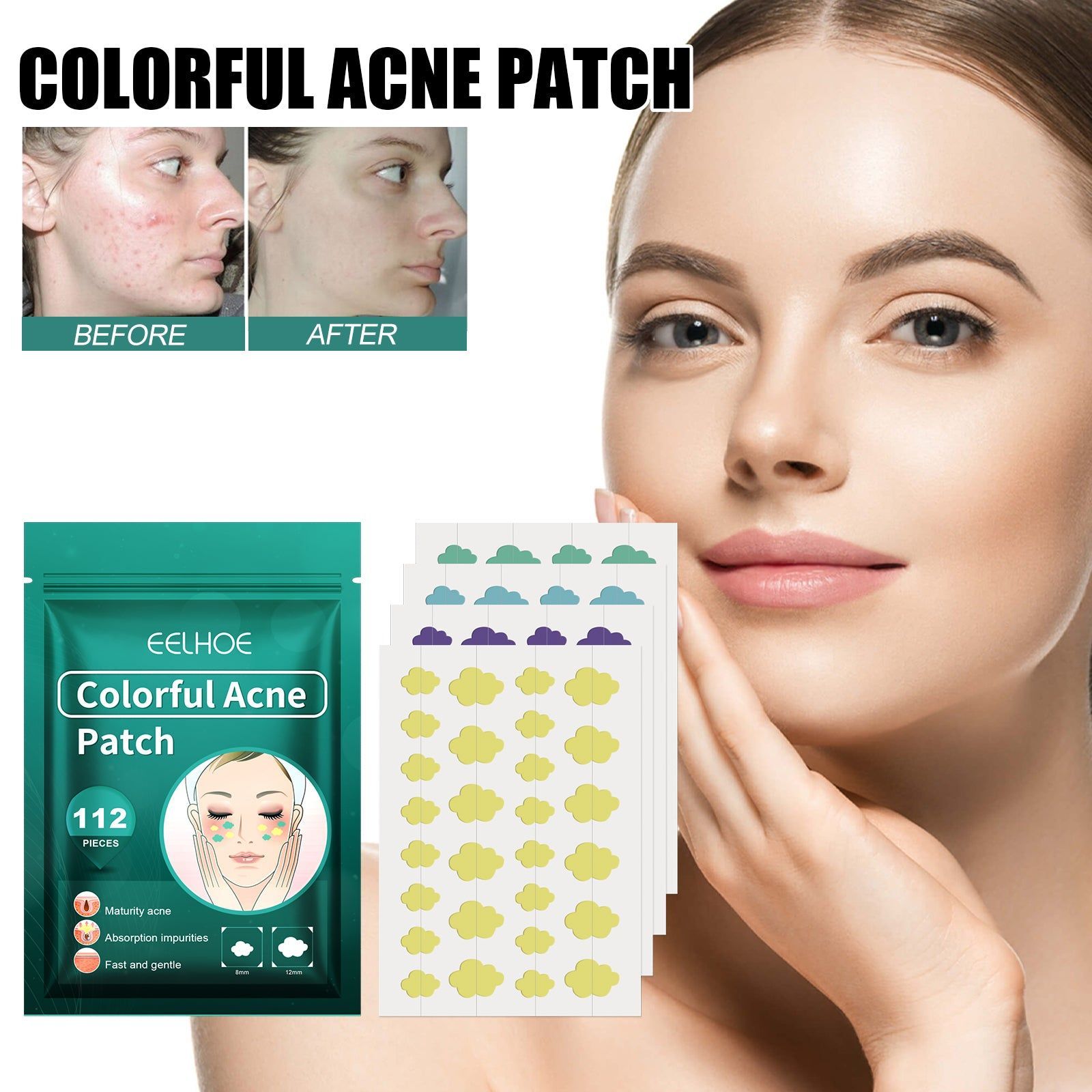 Colorful Acne Patch, Salicylic Acid, Pore Cleanser, Facial Treatment, Clear Skin ,144pieces