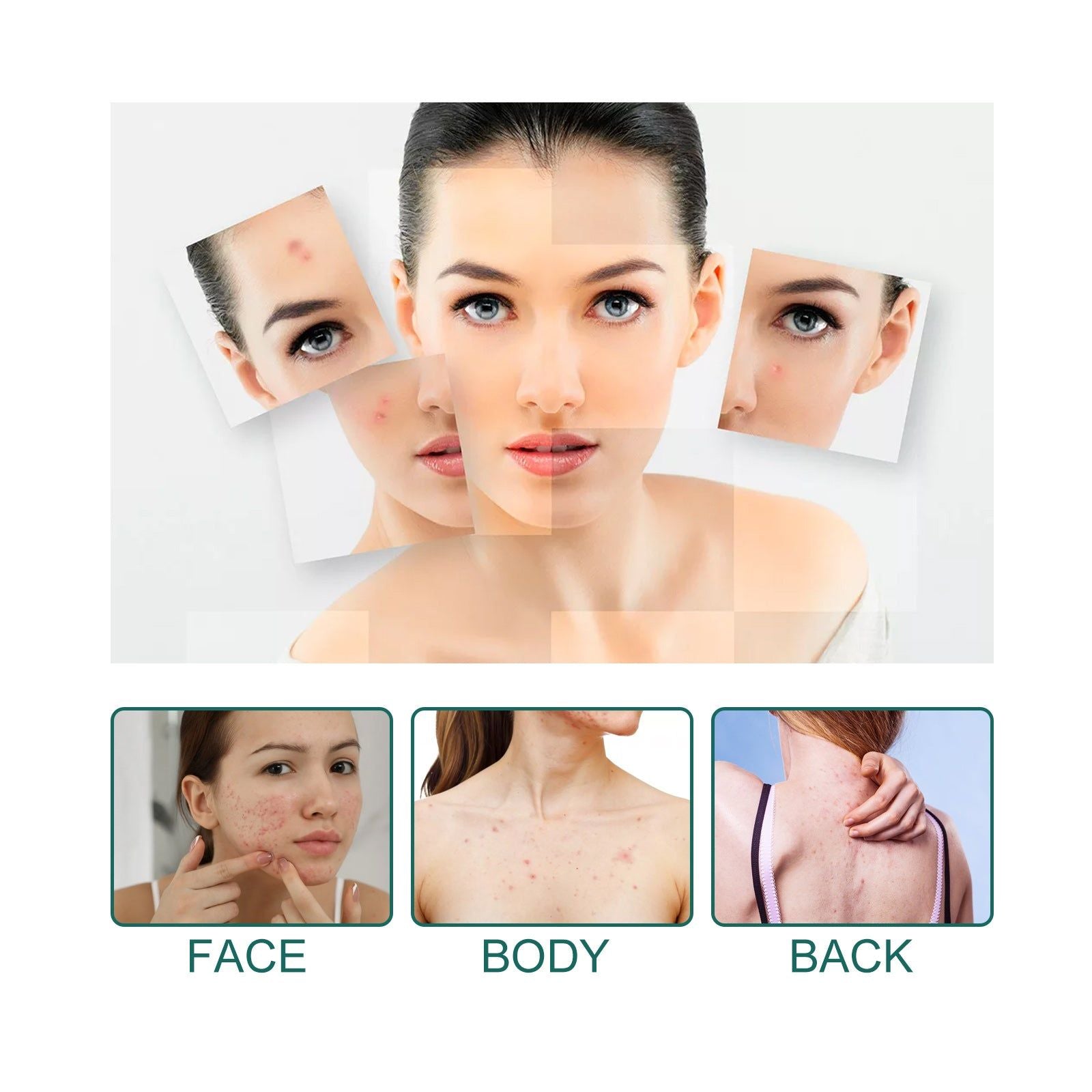 Cover Up Acne Fast, Clear Skin with Star Acne Patches, Gentle & Effective ,112pcs