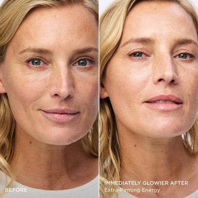 طاقة لشد البشرة بشكل فائق