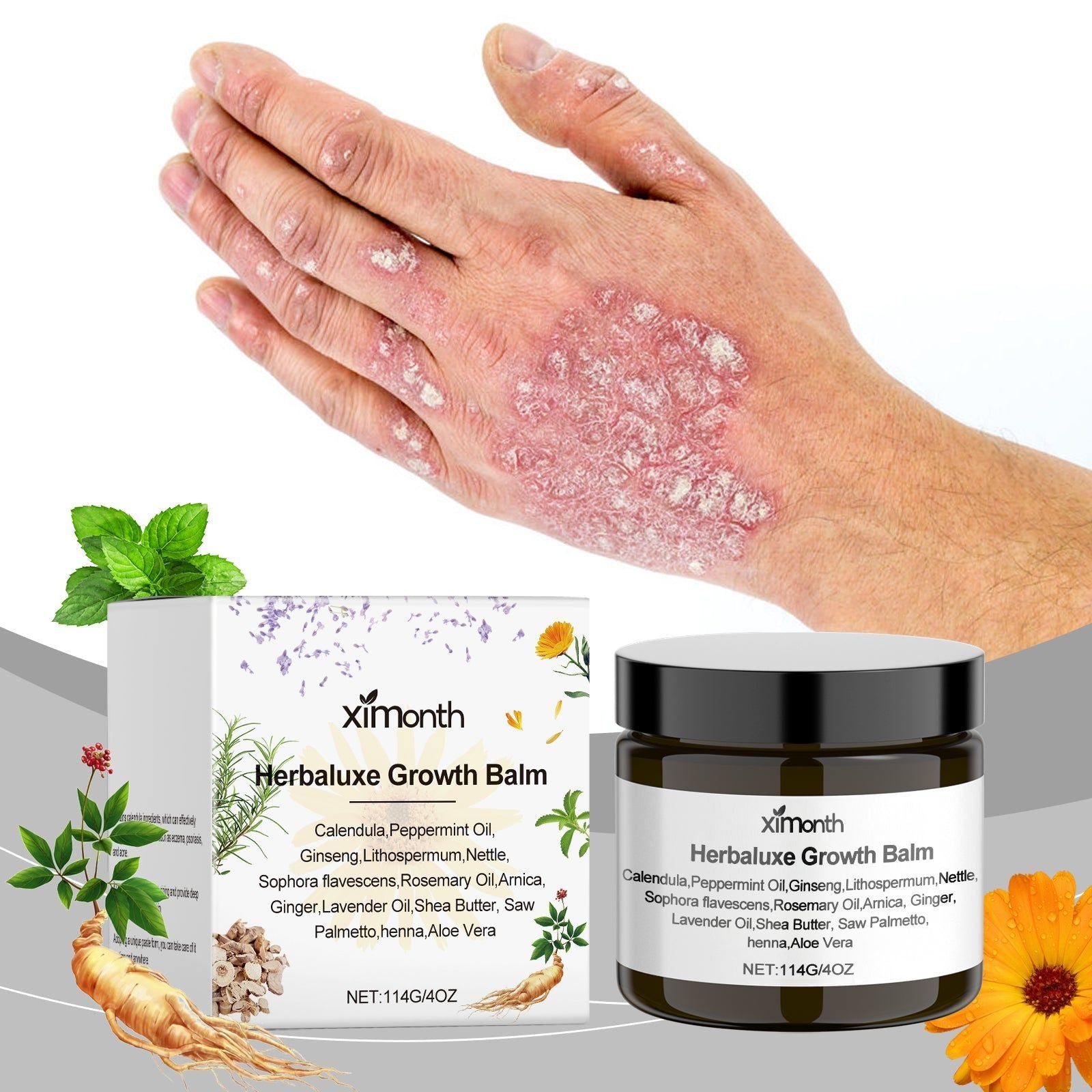 Herbal Care Cream for Gentle Skin, Moisturizes and Repairs, Psoriasis Relief ,114g