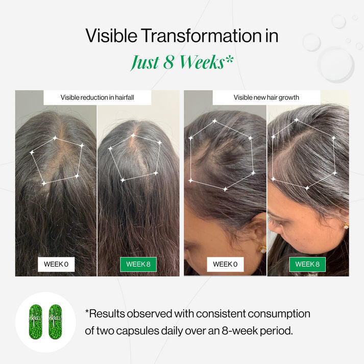 كبسولات بيوتين لإنقاذ الشعر من Beautywise 30 كبسولة