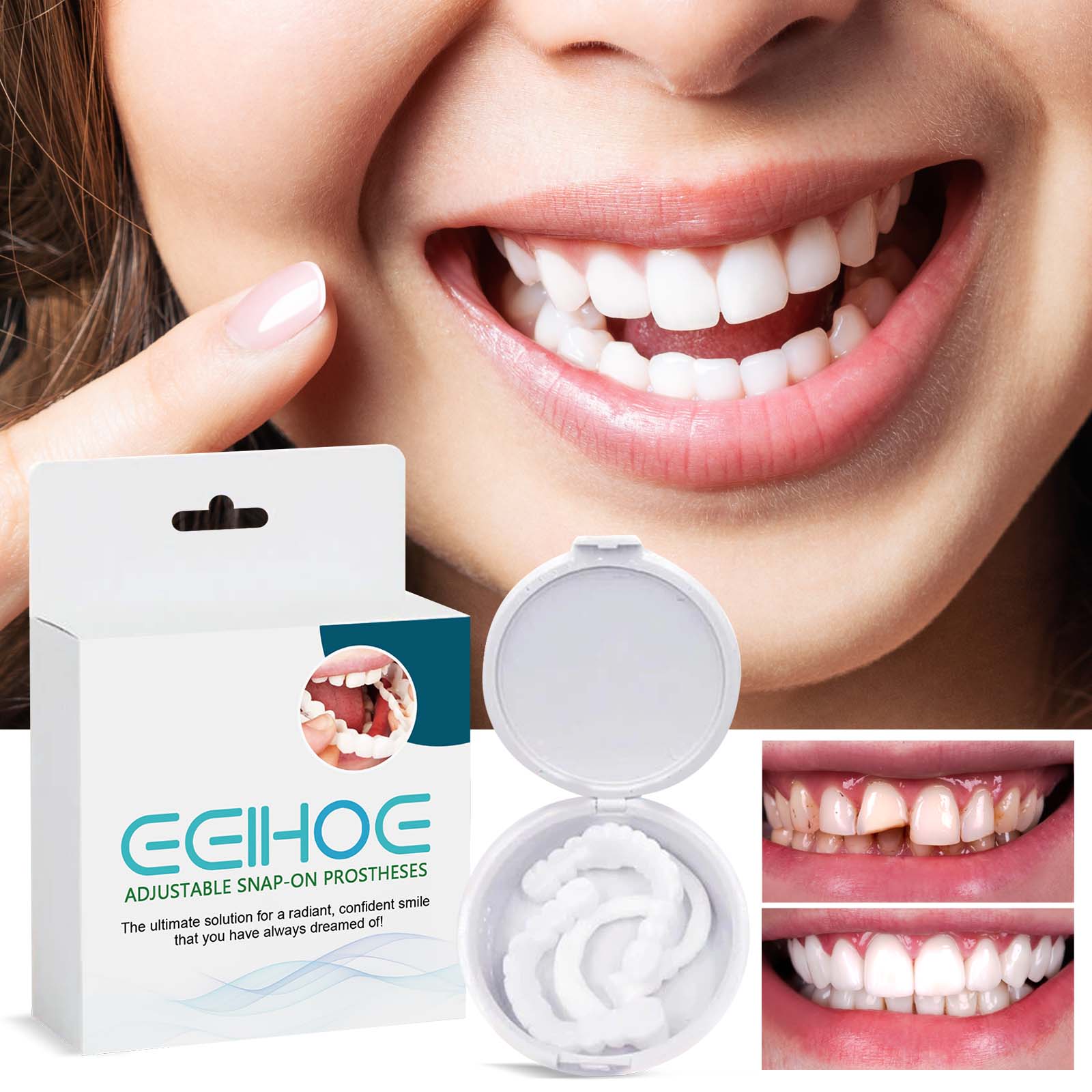 Adjustable Buckle Dentures Dental Kit, Comfortable, Non-Invasive, Easy Fit ,1pairs