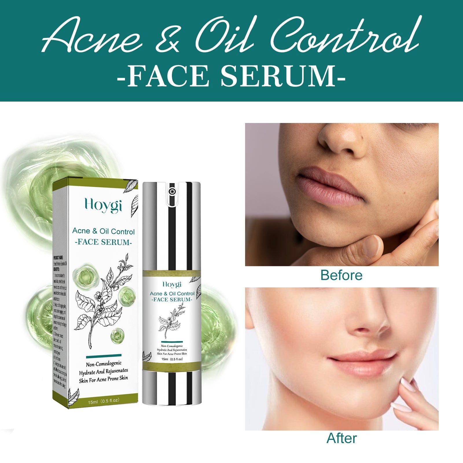 Hydrating Tea Tree Facial Essence, Oil Control, Acne & Wrinkle Repair, Moisturizer ,15ml