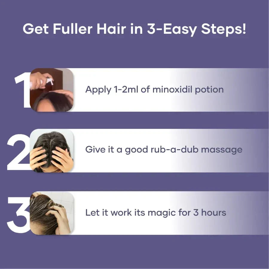 محلول موضعي GHC Saturn minoxidil 60 مل/2.0 FL OZ