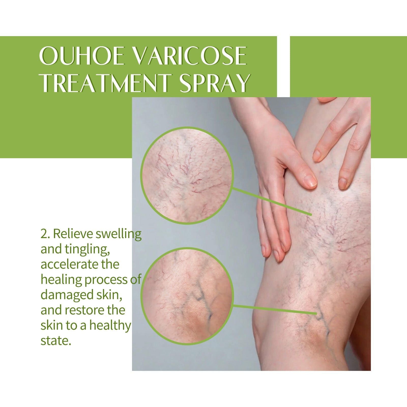 Revitalize Legs with Varicose Spray, Fast Relief for Swelling, Blood Vessel Care ,100ml
