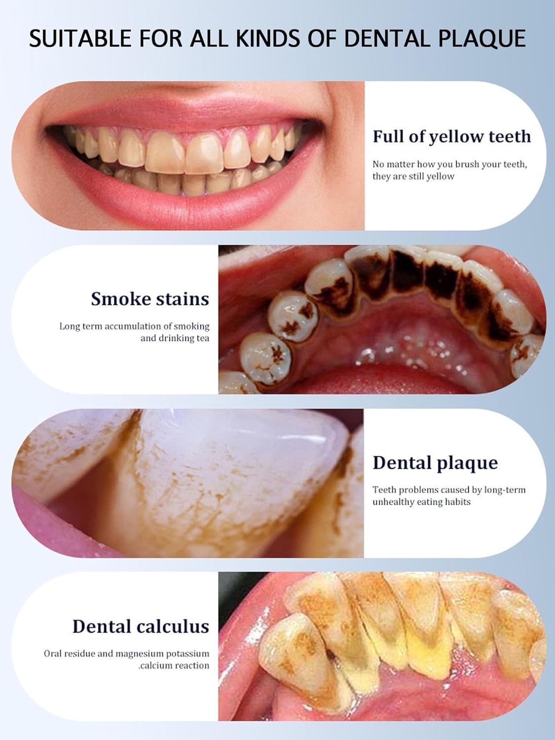 Electric Teeth Cleaner Teeth Cleaning Dental Cleaner Tar Remover