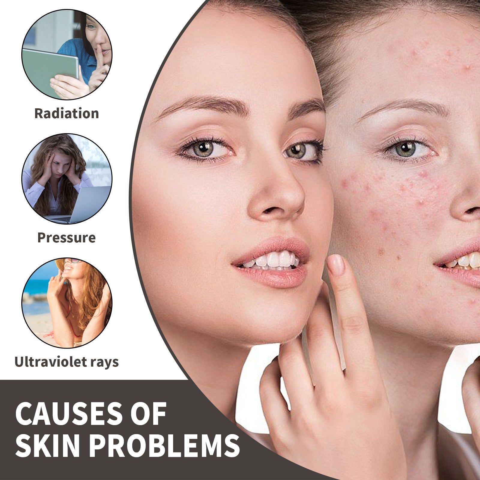 Brighten Skin Serum for Acne, Pimples, and Dark Spots, Hydrating, Anti-Inflammatory ,30ml