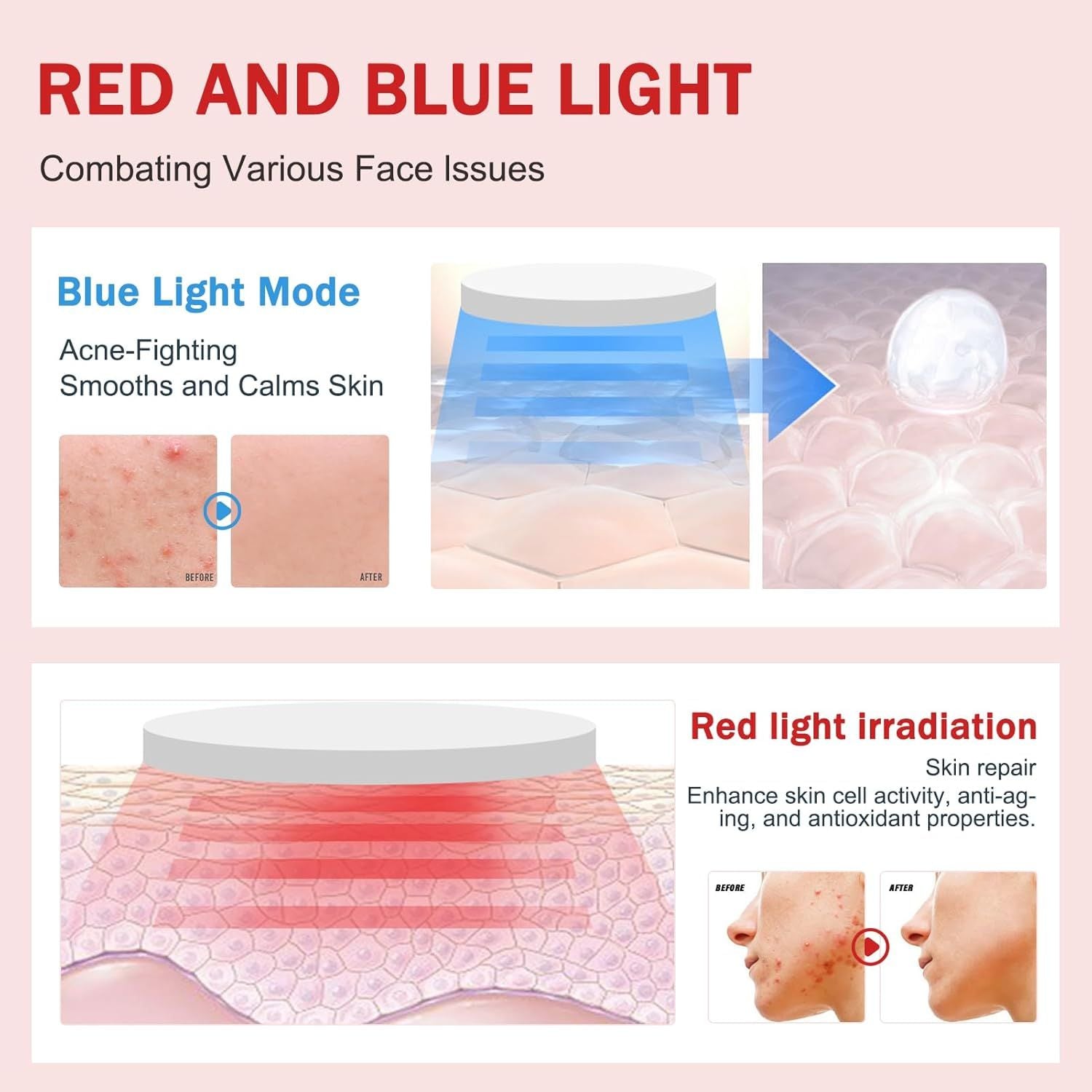 Electric V Face Shaping Massager Intelligent Face Lifting Belt Machine EMS Facelifting Device