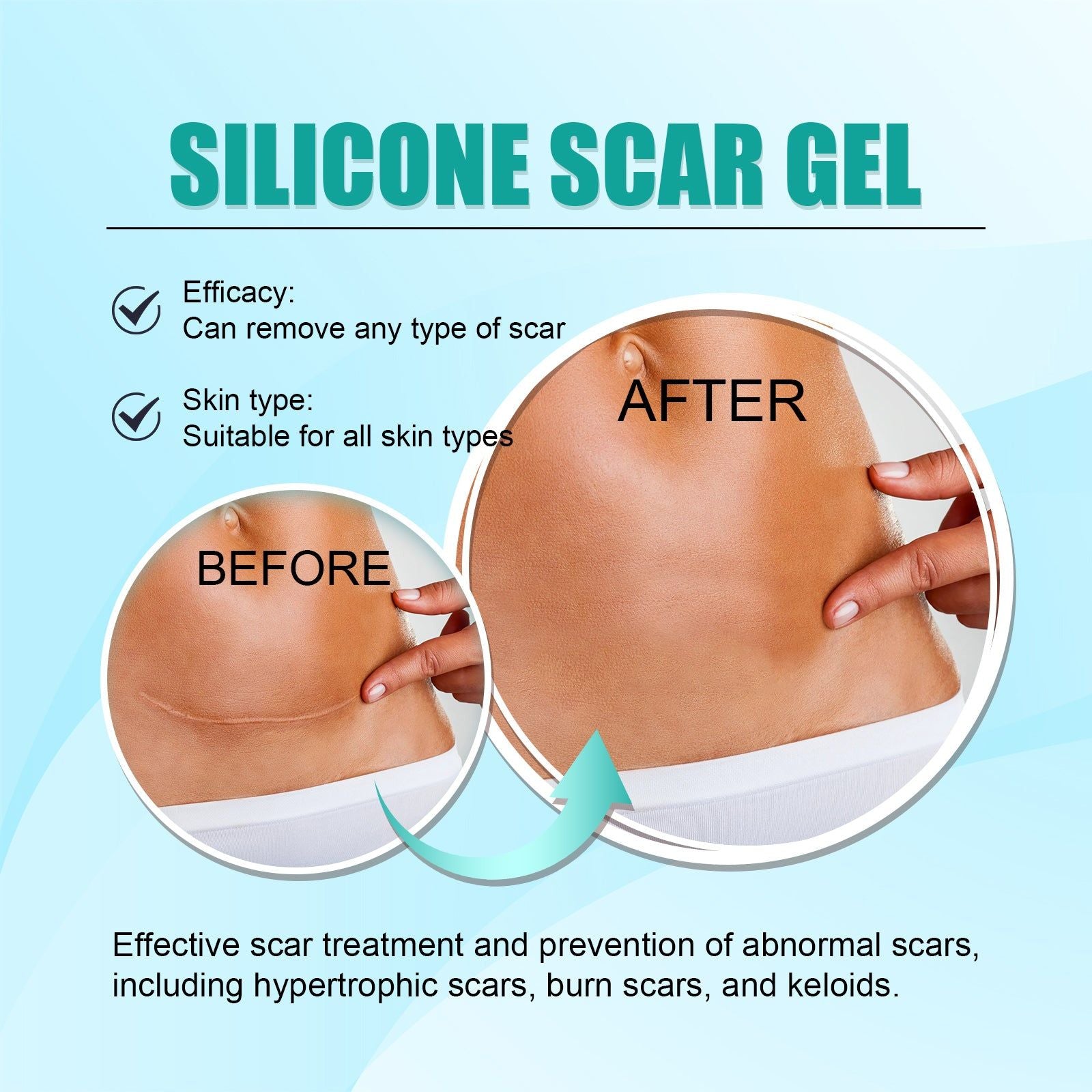 Clinically Proven Scar Care Gel, Fade Scars, Reduce Scar Formation, Smooth Skin ,15g