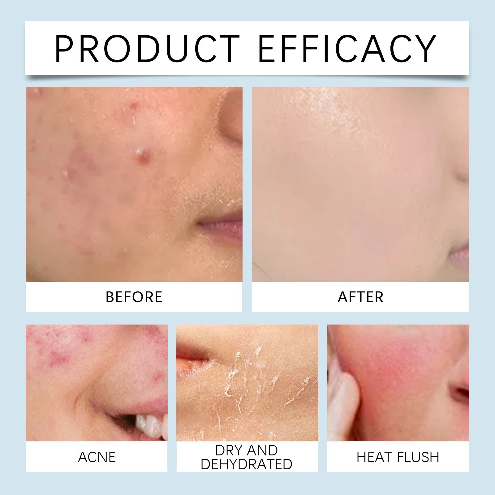 Hydrating Hyaluronic Acid Serum with Microneedle Roller for Water Replenishment and Glowing Skin ,10ml/box