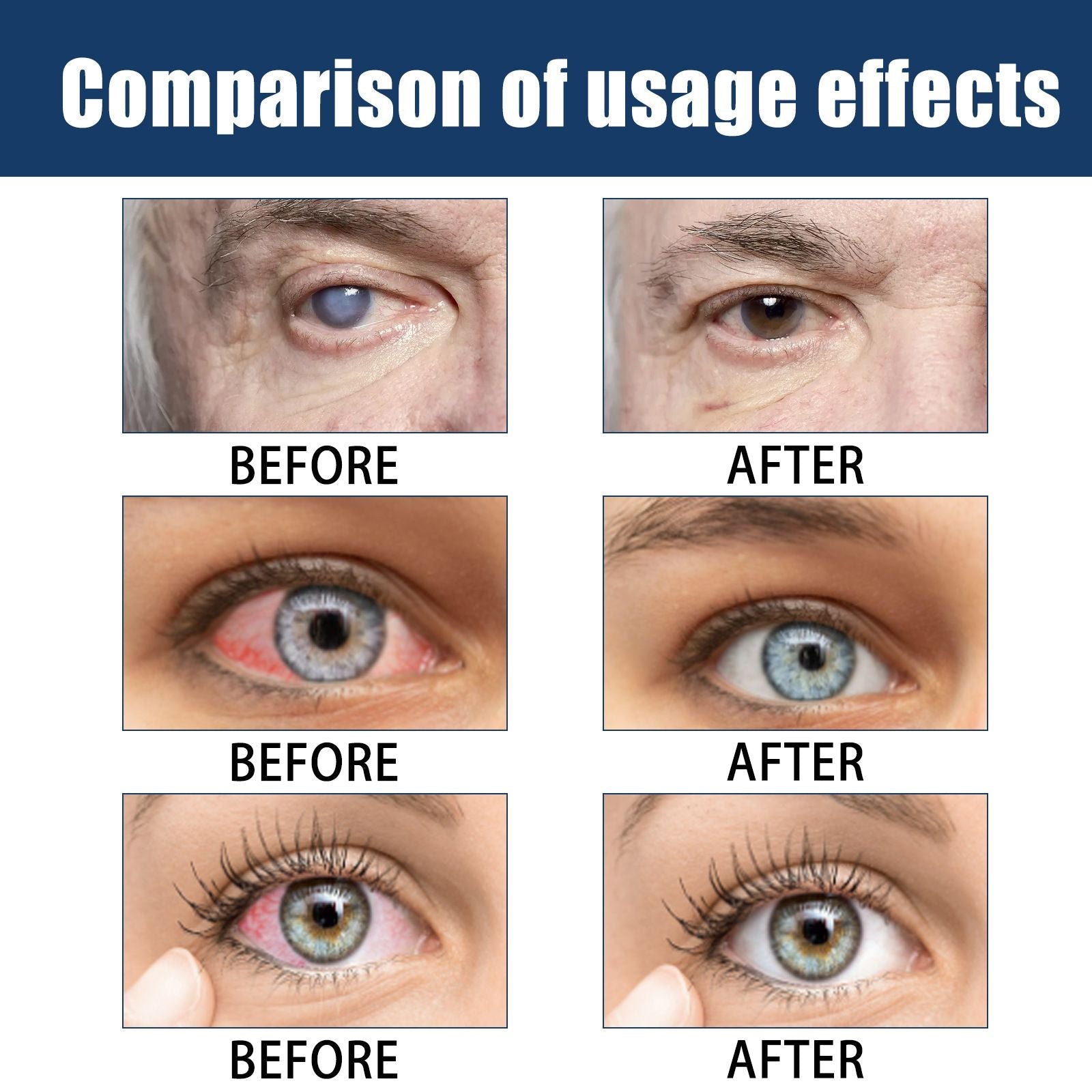 Eye Care Drops for Dry Eyes & Fatigue Relief 15ml