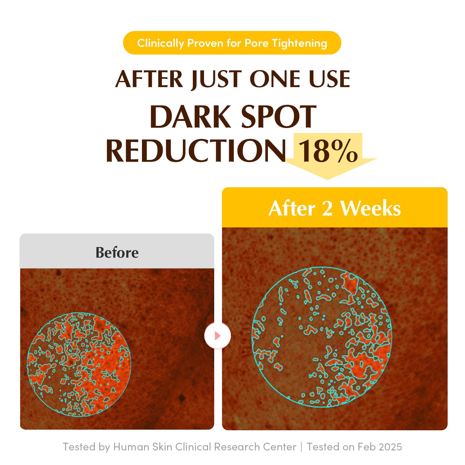 Eqqualberry Collagen Glow Up Hydrogel Mask 30G | 4Sheets