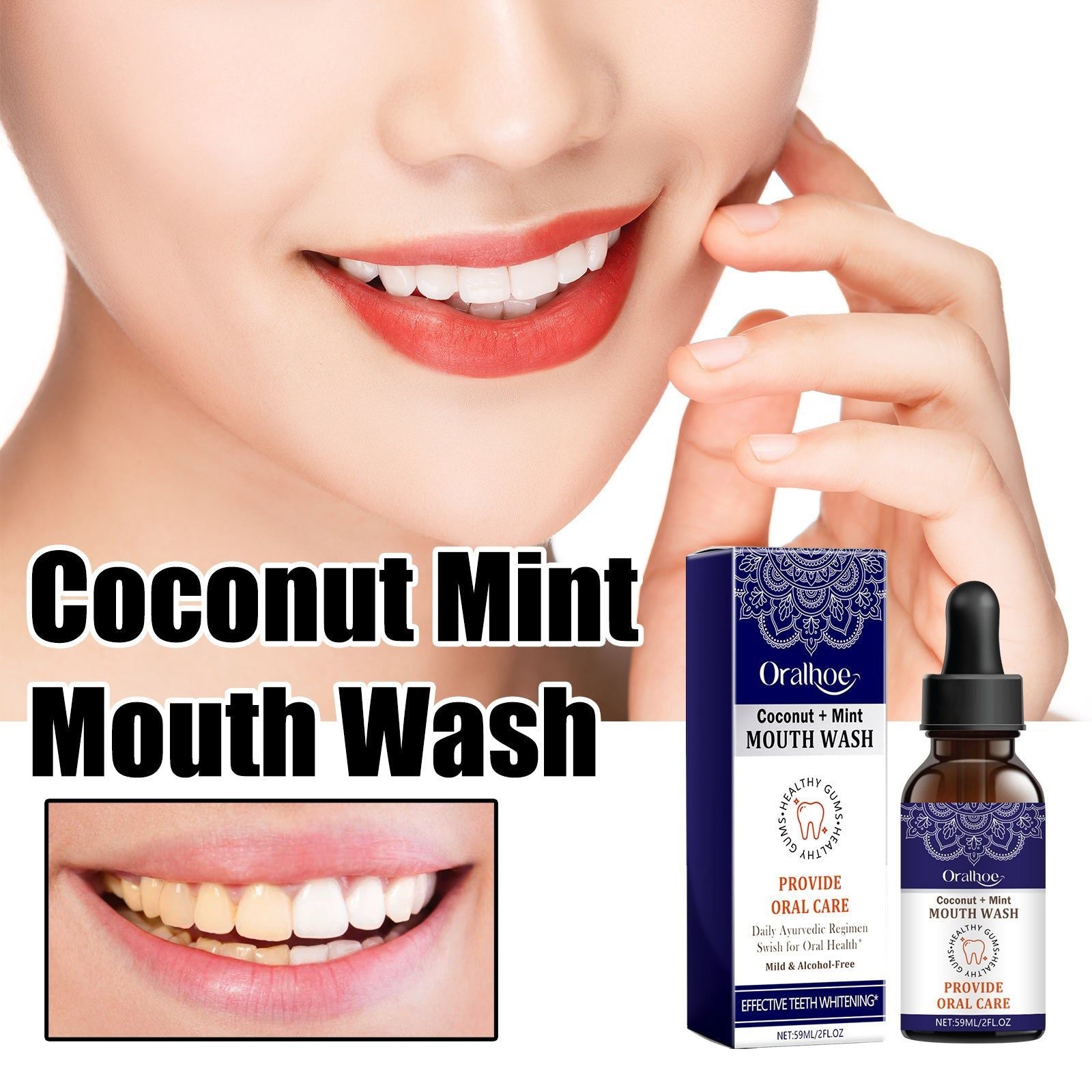 Coconut Mint Oral Odor Treatment Spray, Fresh Breath, Whiten Teeth, Gum Relief ,59ml