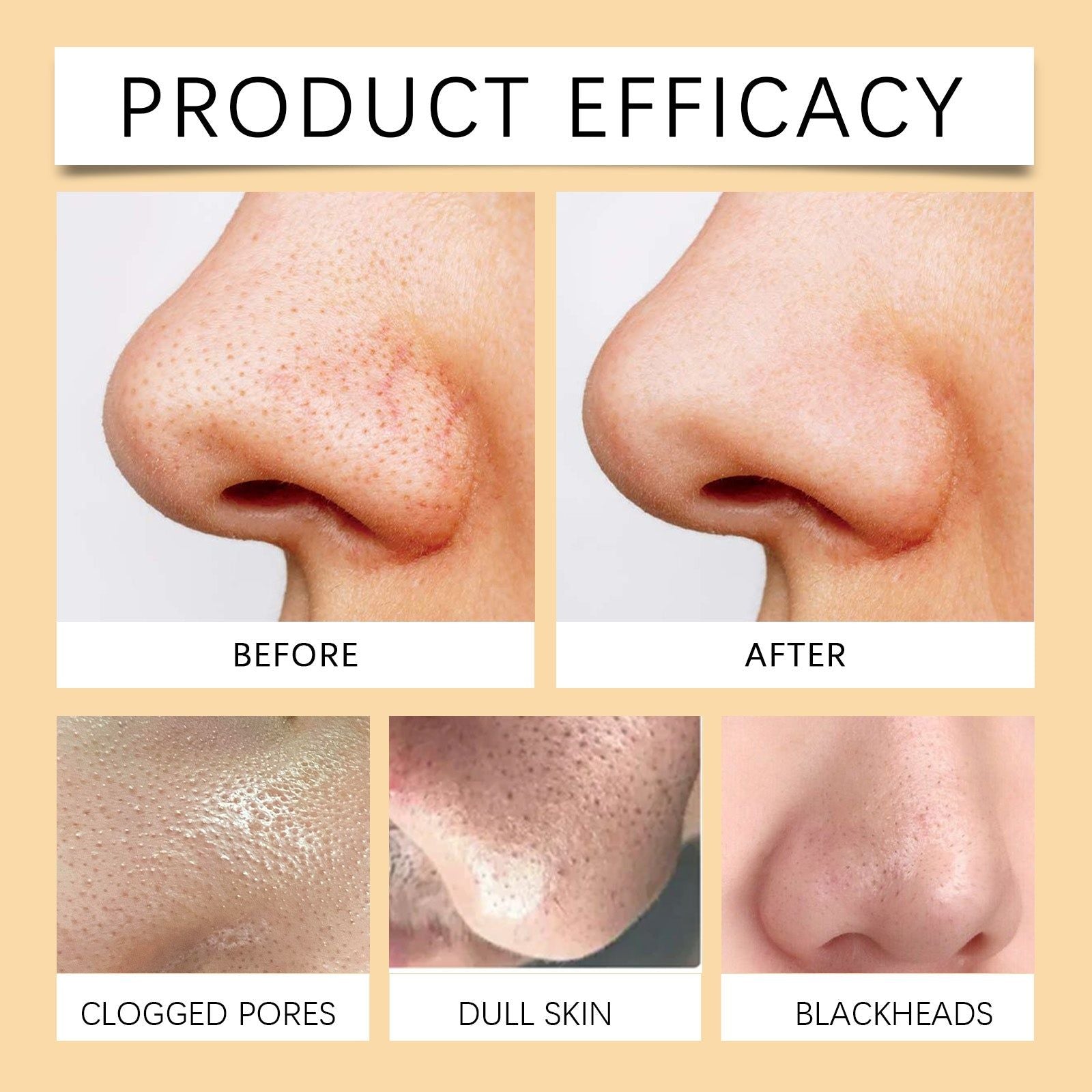Brightening Enzymes Exfoliating Gel, Reduce Blackheads, Clear Pores, Glow Skin ,50g