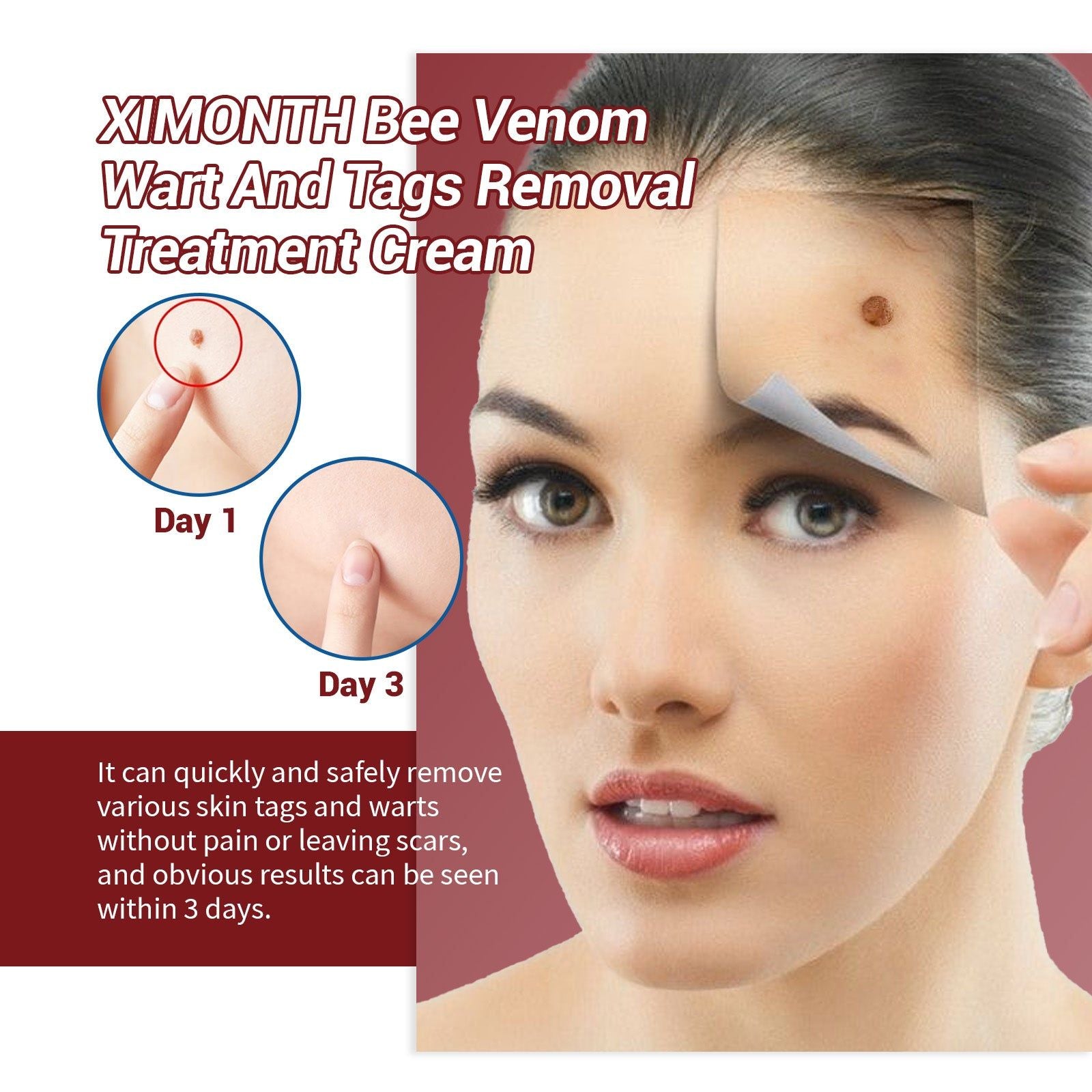 Bee Venom Wart Removal Cream, Skin Lightening, Gentle Wart & Skin Tag Treatment ,20g