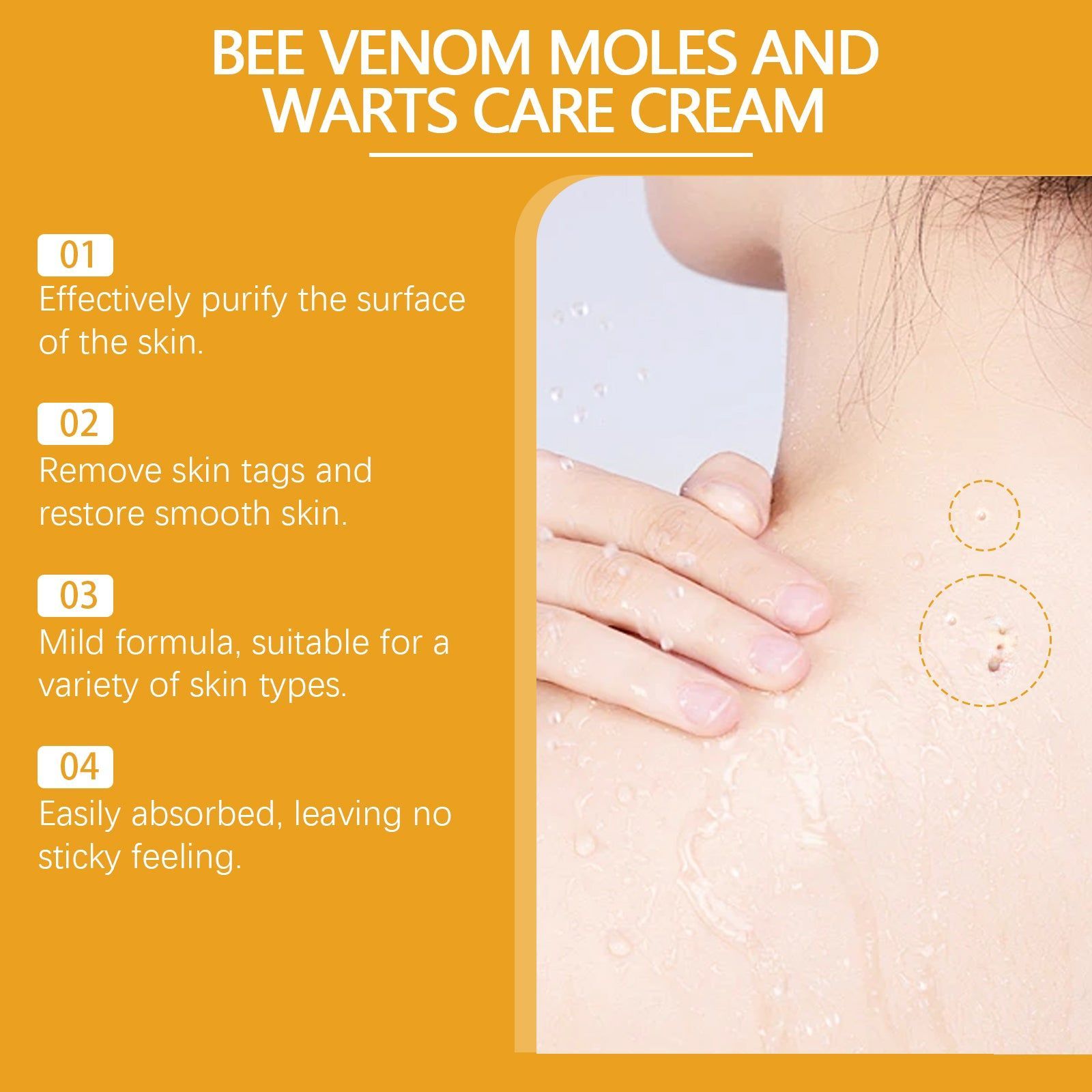 Beesvenom Wart Care Cream, Gentle Body Care, Skin Lightening, Smooth & Luminous ,30g