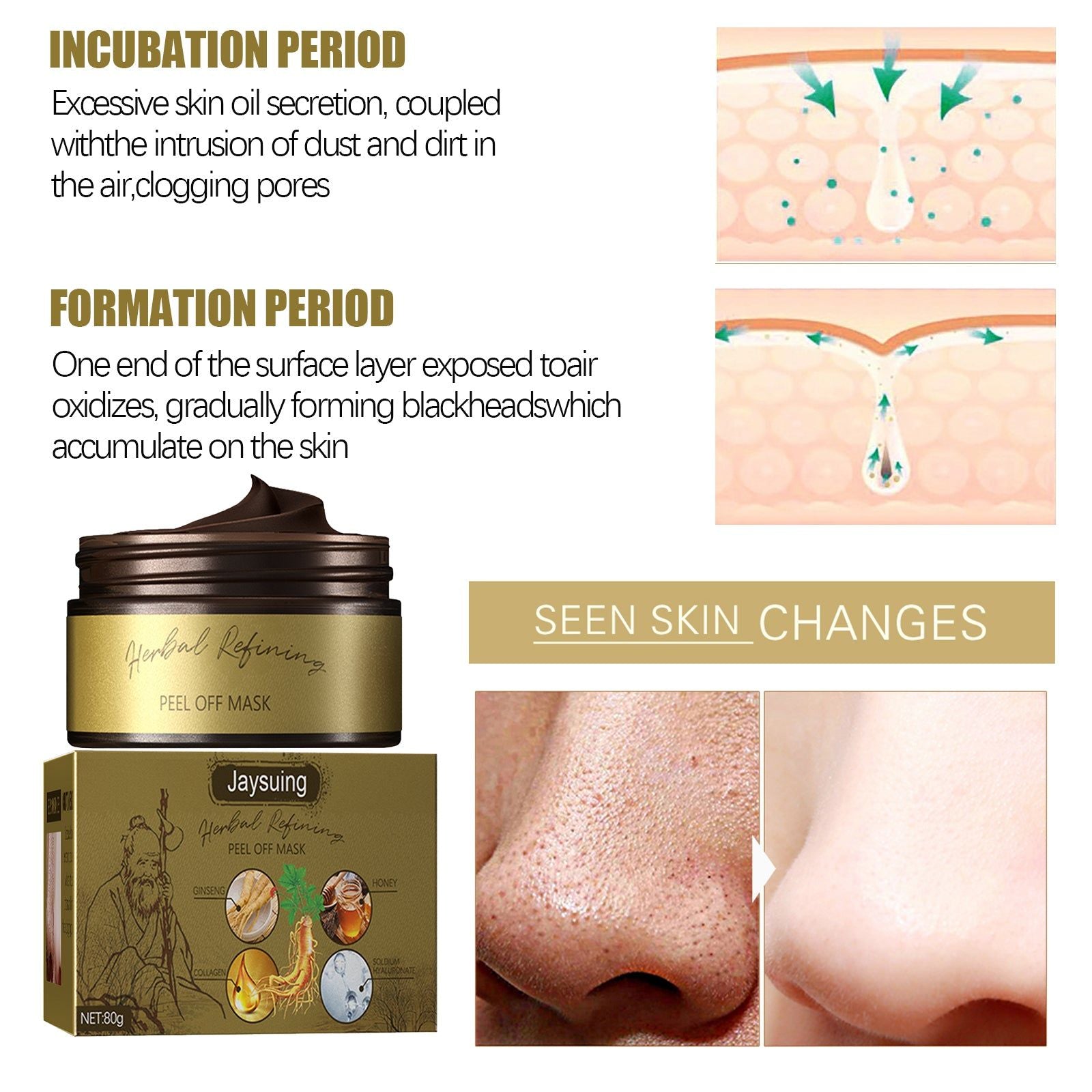 Clear Pores Blackhead Remover Mask, Hydrating Peel for Clean Skin, Pore Shrink ,80g