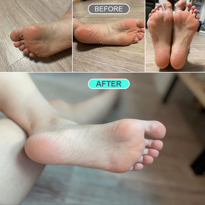 Kocostar Premium Foot Peeling Pack Small 32ML 1's