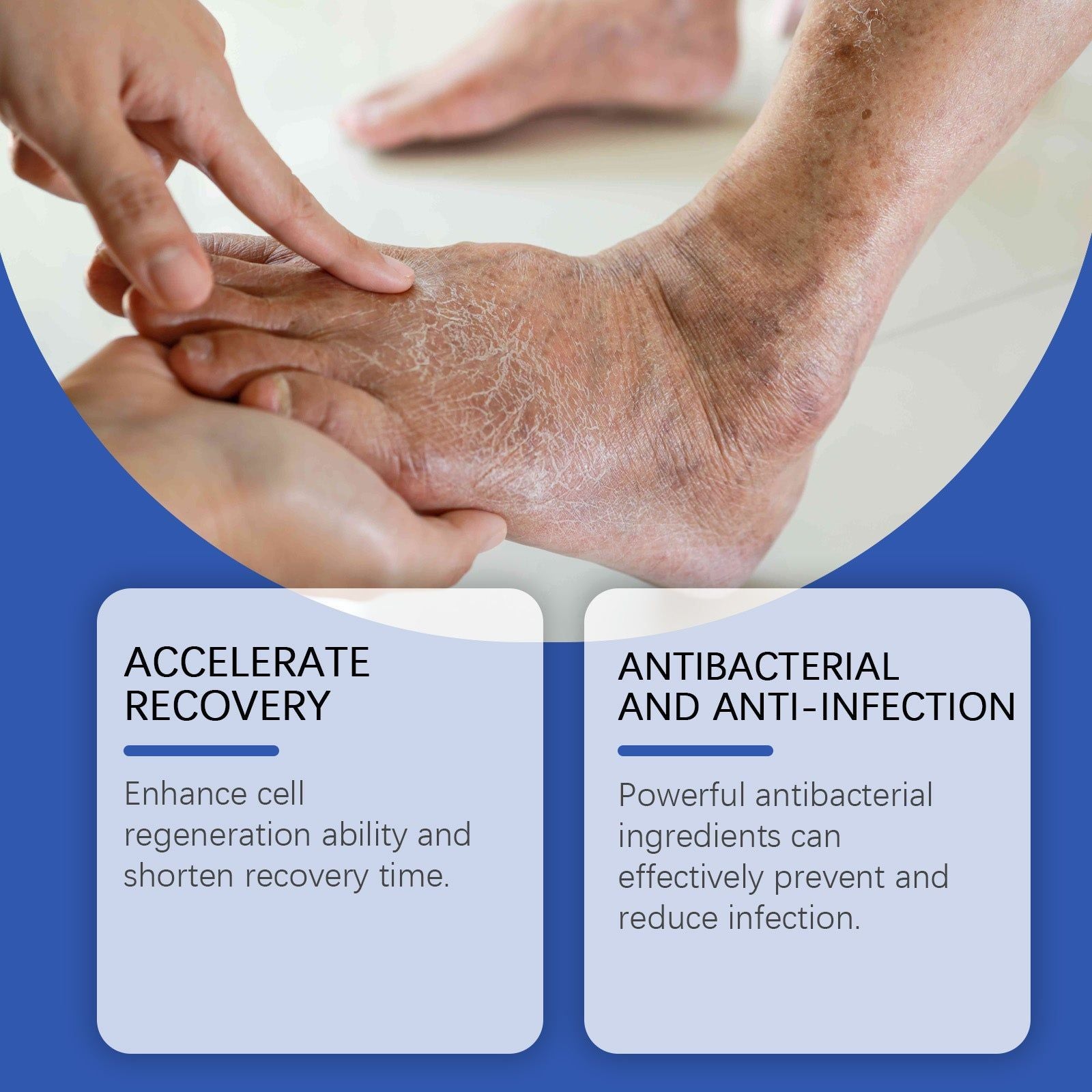 Body Care Cream for Diabetic Wounds, Moisturizing, Soothing, Fast Healing ,20g