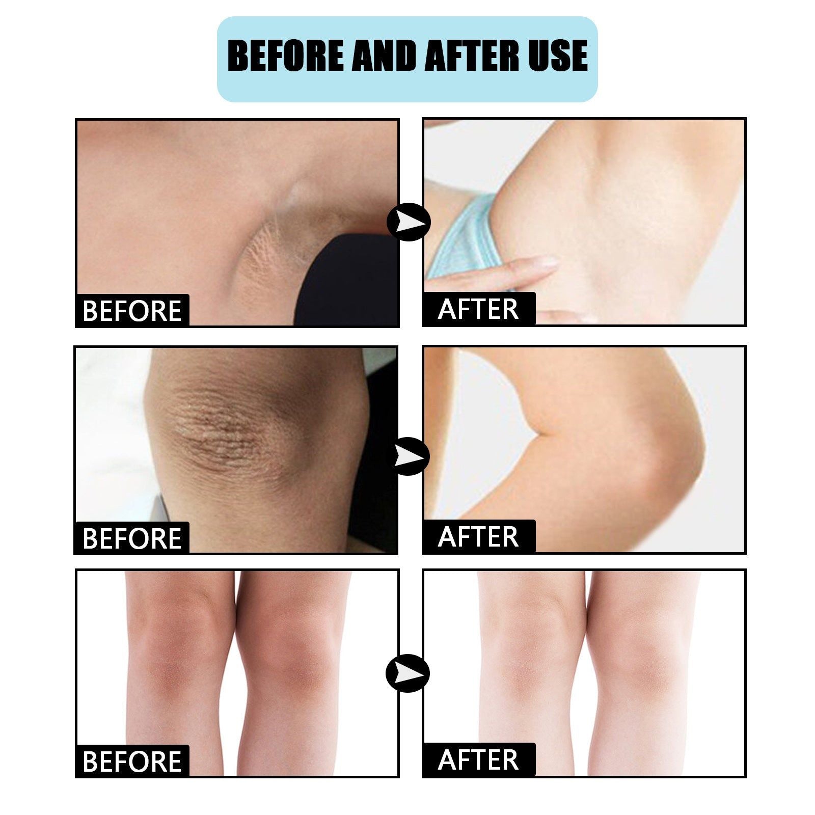 Brightening Underarm Beauty Cream, Moisturizing, Skin Tone Lightening, Fast Results ,60ml