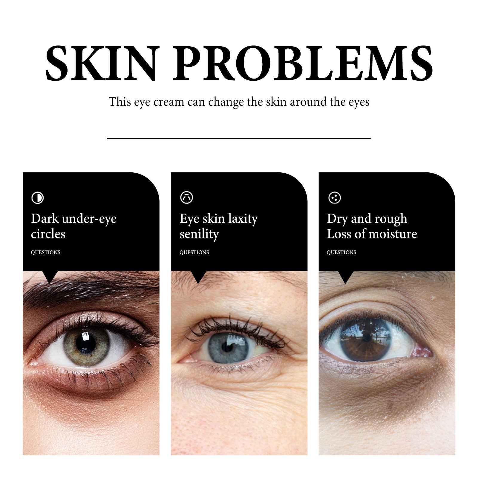 Revitalize Your Eyes with Gentle Hydrating Eye Care Cream for Dark Circles and Aging ,30g