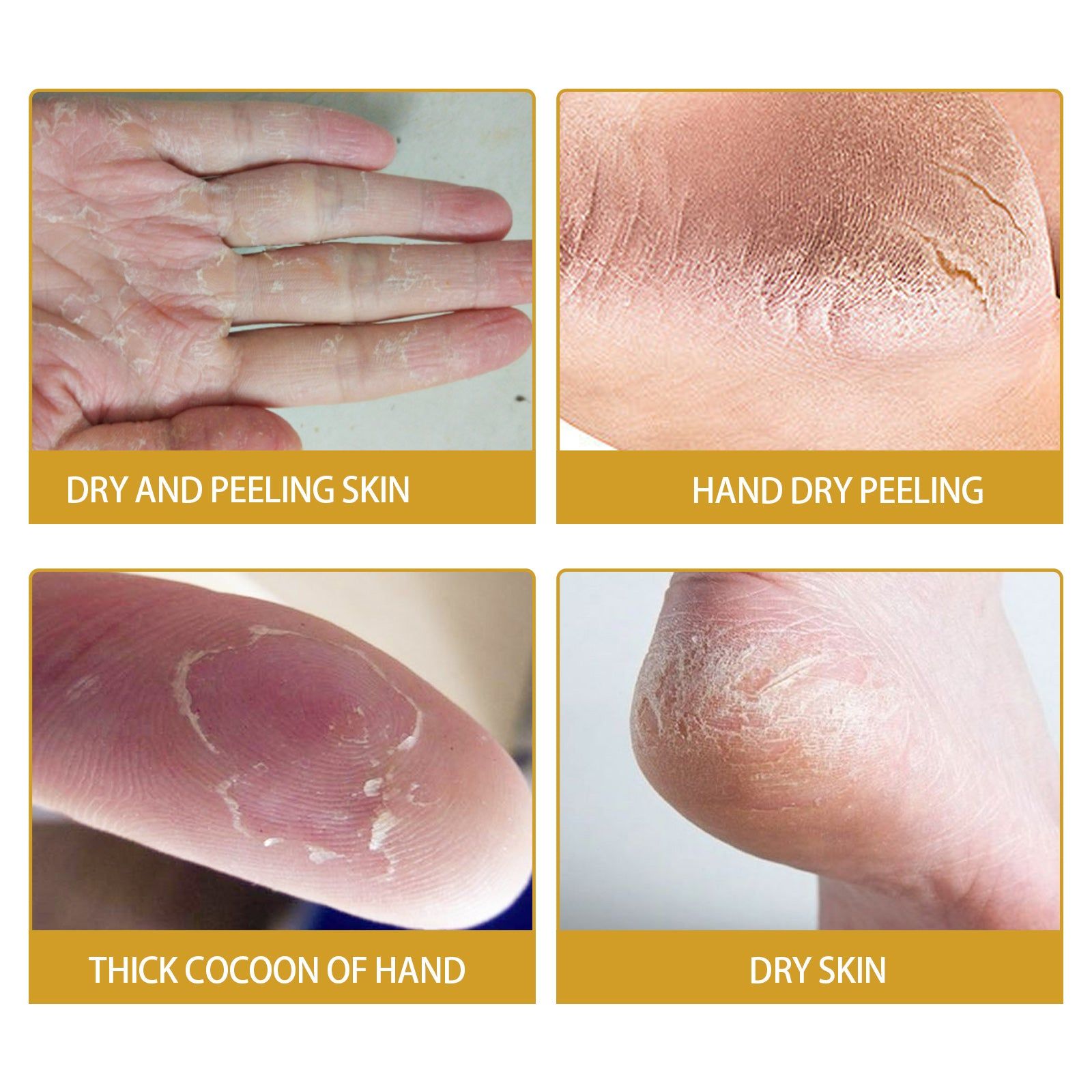 Banana Repair Cream for Dry Rough Hands Feet, Hydrating, Soothing, Anti-Cracking ,20g