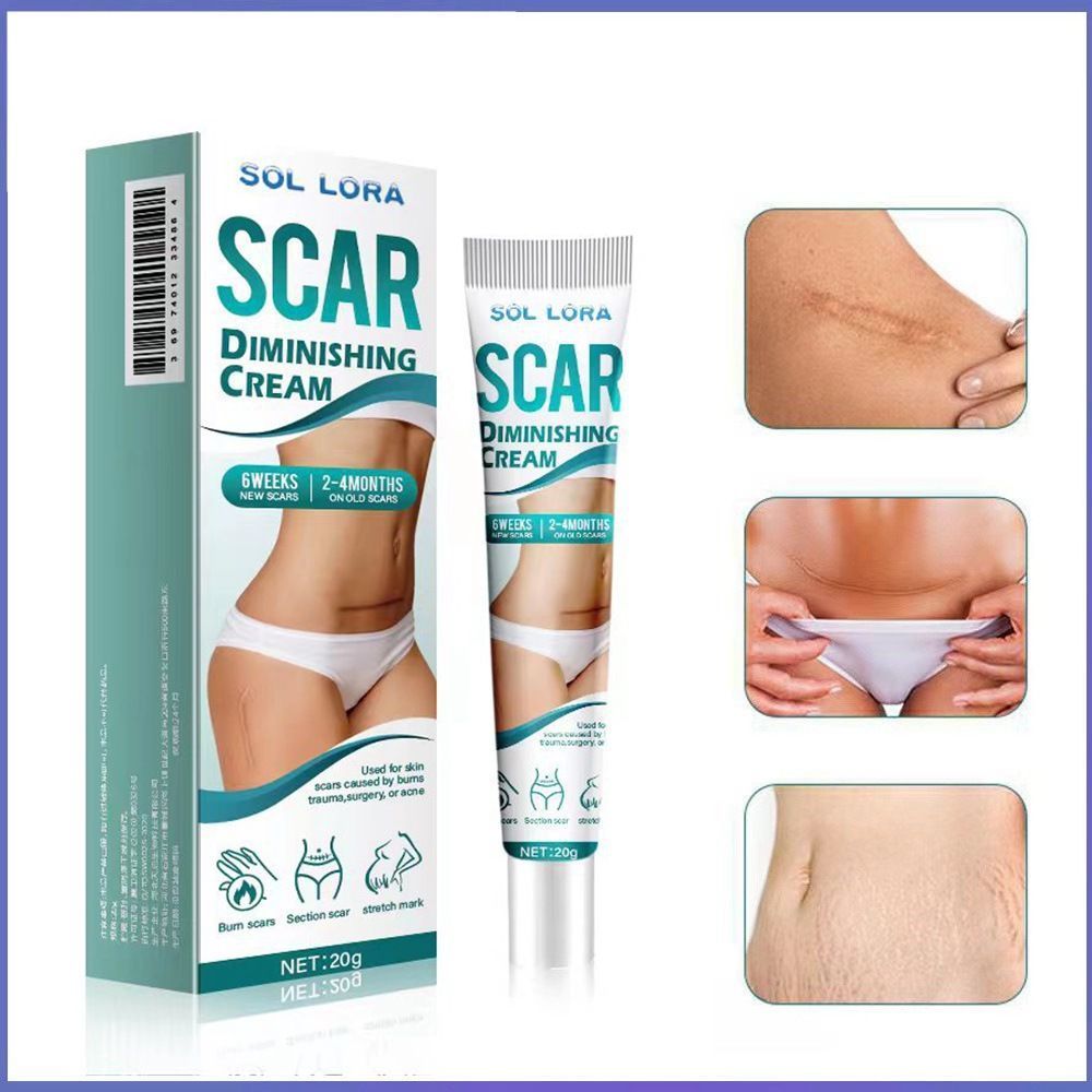 SOL LORA Scar Diminishing Cream - Herbal Formula for Surgical Scars, C-Section Scars, Acne Marks & Postpartum Stretch Marks