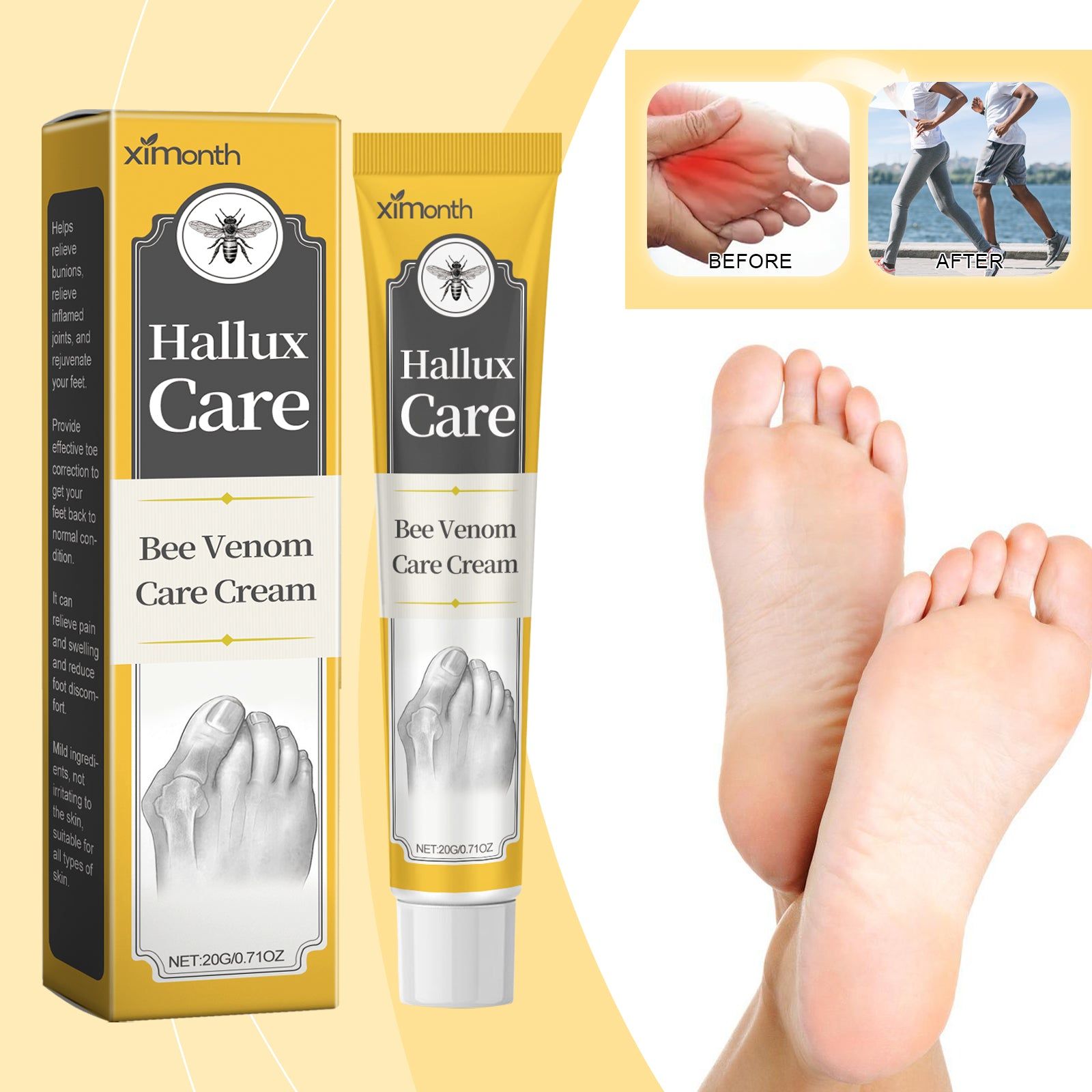 Bee Venom Cream for Bunion Pain, Joint Inflammation, Natural Relief ,20g