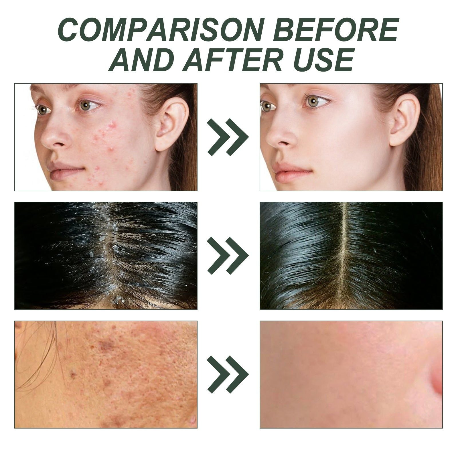 Revitalize Skin with Rosemary Essential Oil, Acne, Brightening, Moisturizing, Hair & Skin Care ,60ml