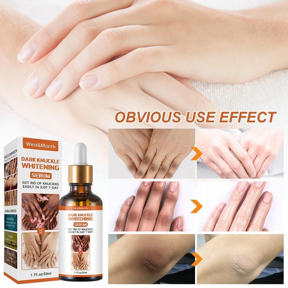 Dark Knuckle Whitening Serum Hand Elbow Knee Brightening Serum Skin Moisturizer