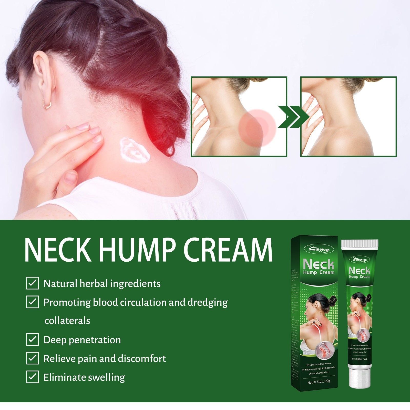 Relieve Cervical Spine Pain, Sedentary Muscle Soreness, Neck Hump Cream, Natural Joint Care ,20g