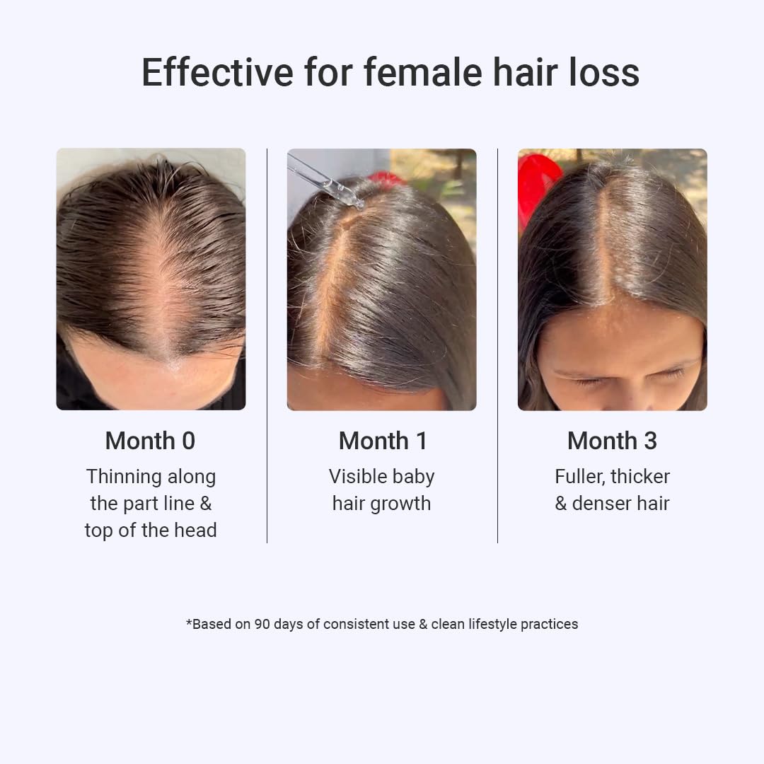 Arata Intensive Hair Growth Serum - 3% Redensyl, 3% Procapil (30 Ml)