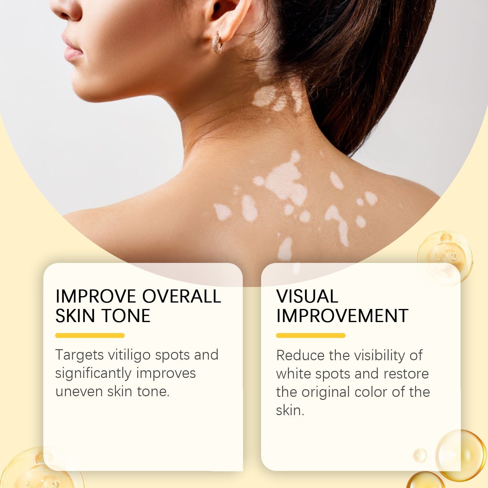 Bee Venom Skin Care Cream for White Spots, Pigmentation, Vitiligo, Moisturizing, Natural Repair ,20g