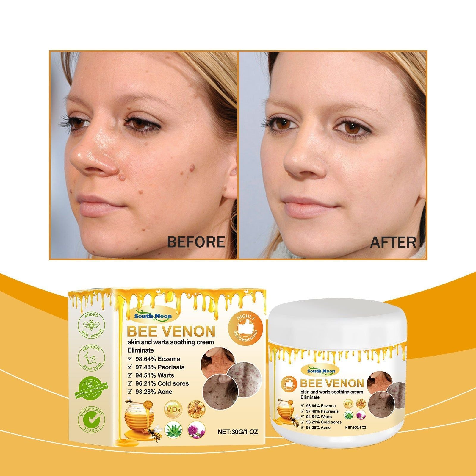 Bee Venom Body Care Cream, Brightening, Moisturizing, Wart & Blemish Treatment ,30g