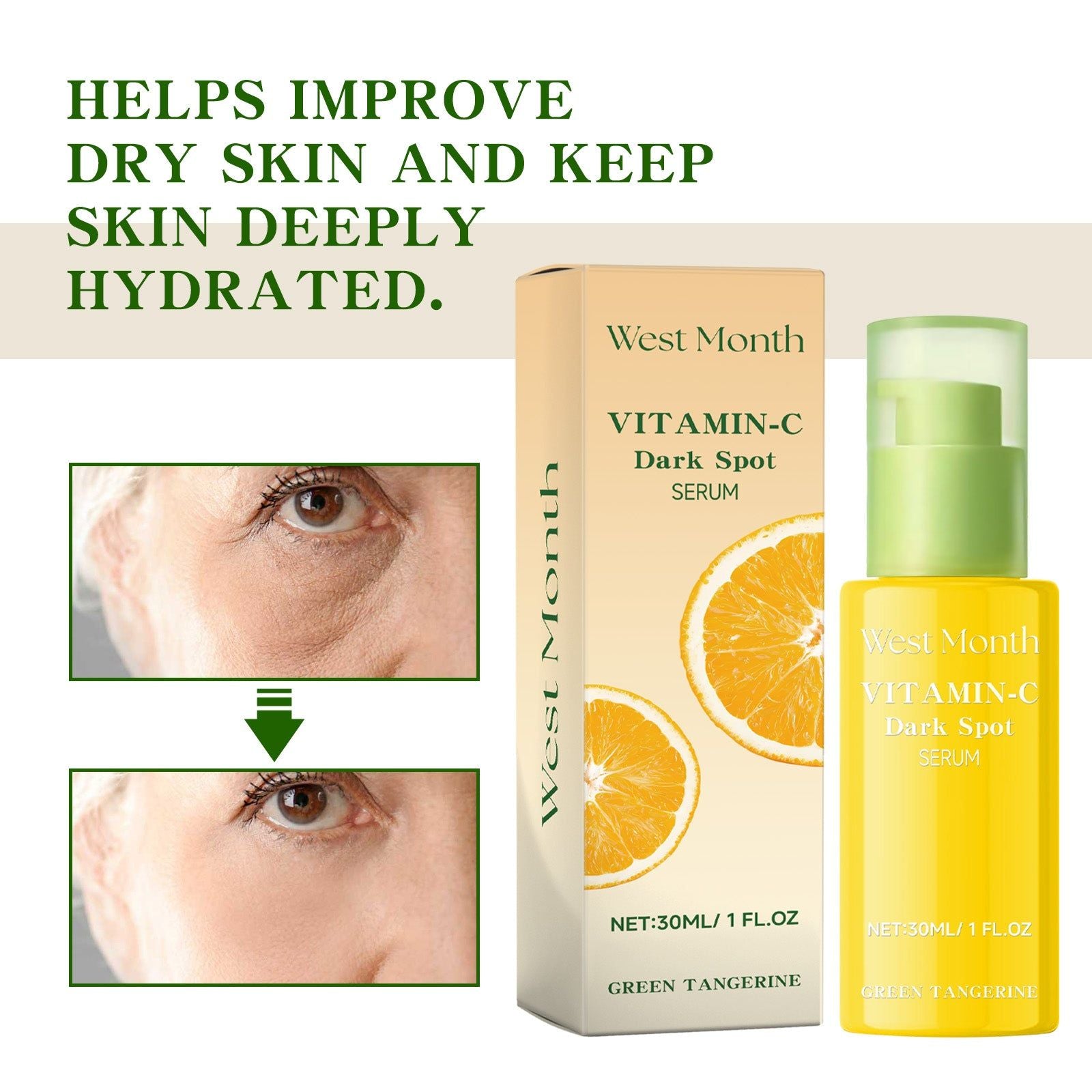 Brightening Skin Vitamin C Serum for Dull Skin, Hydrating Dark Spot Corrector ,30ml