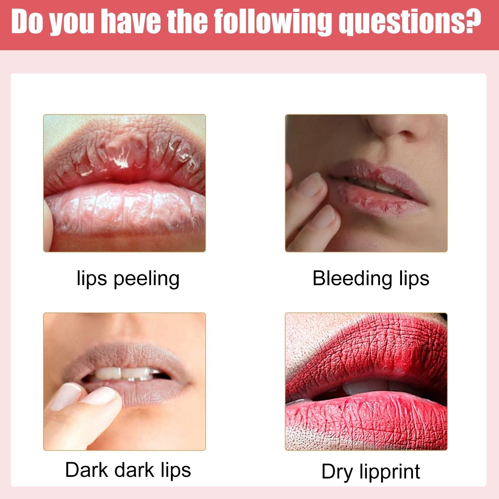 Brighten Lips Naturally, Hydrating Lip Balm, Anti-Crack Repair, Moisturizing Gloss ,30g