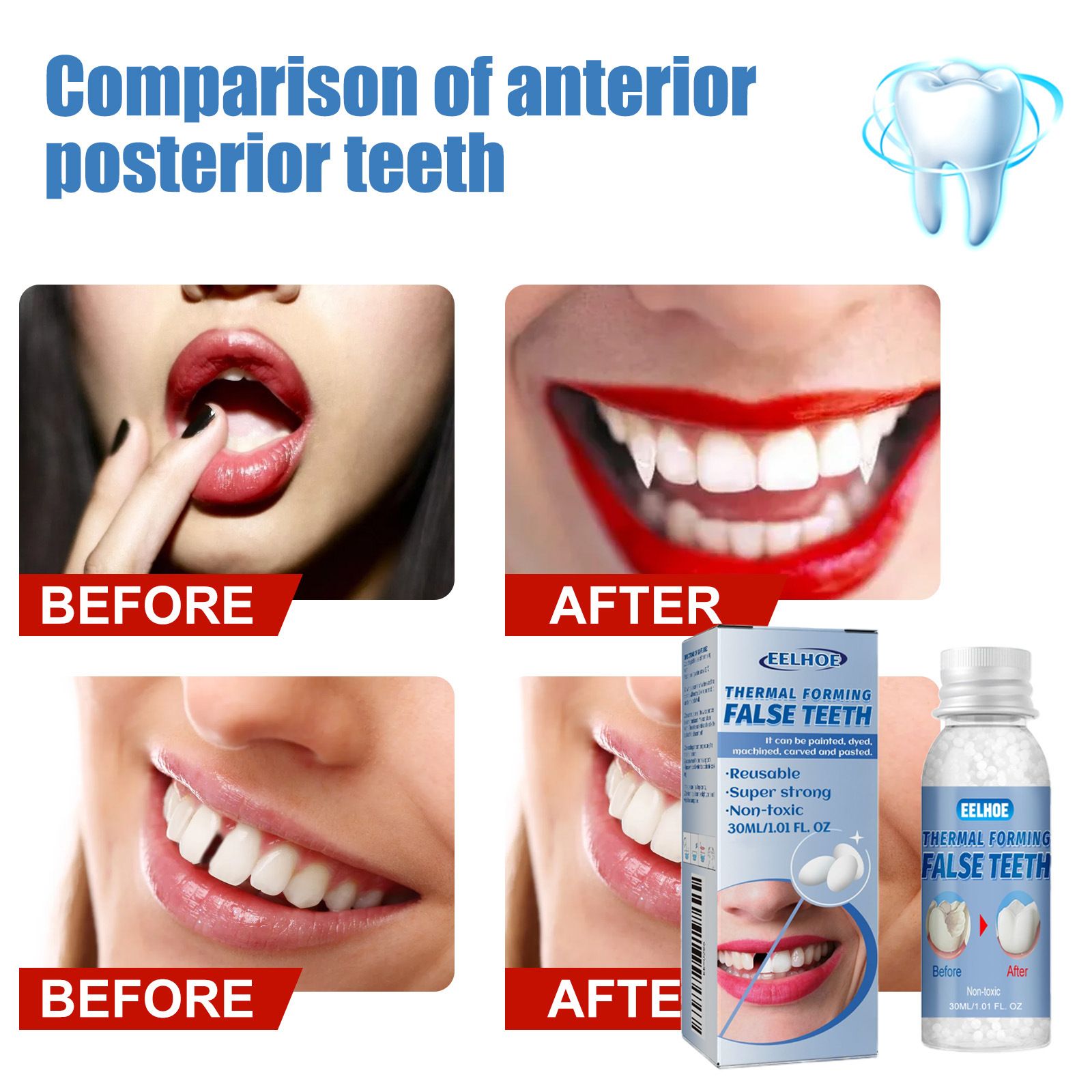 EELHOE Thermal Forming False Teeth Beads, Temporary Cosmetic Tooth Filler, Moldable Denture Adhesive for Smile Makeover