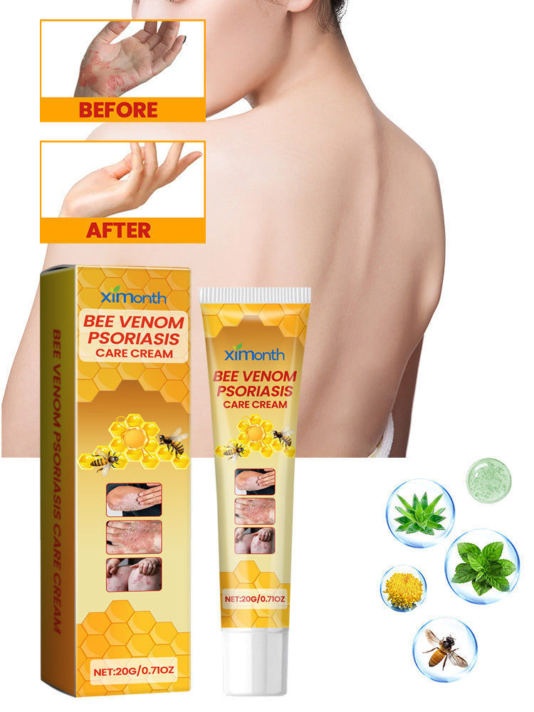 Bee-Poison Cowhide Moss Cream for Skin Care, Relieves Redness, Itchiness, Psoriasis ,20g
