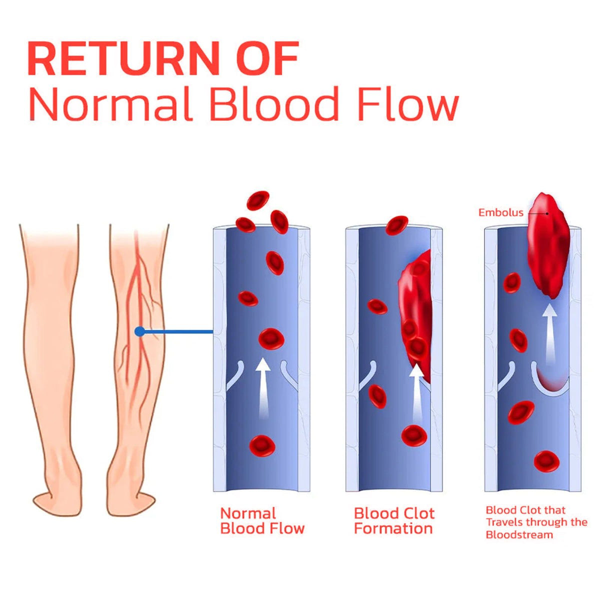 Revitalize Your Body Care with Infrared Tourmaline Acupressure Insoles for Pain Relief ,1pair