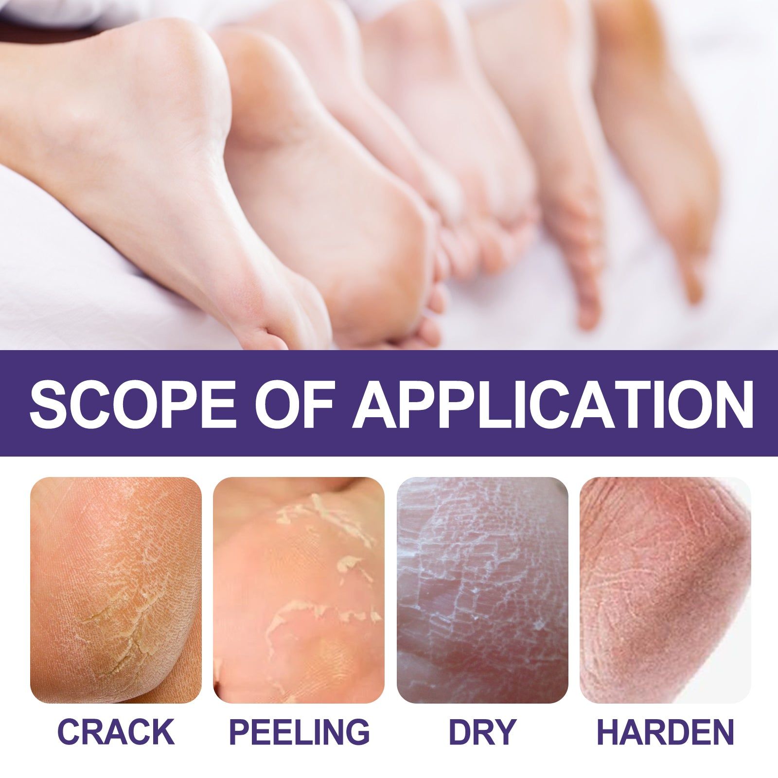 Anti-Crack Skin Care Cream, Deep Moisturizer for Soft, Smooth, Radiant Skin ,120g