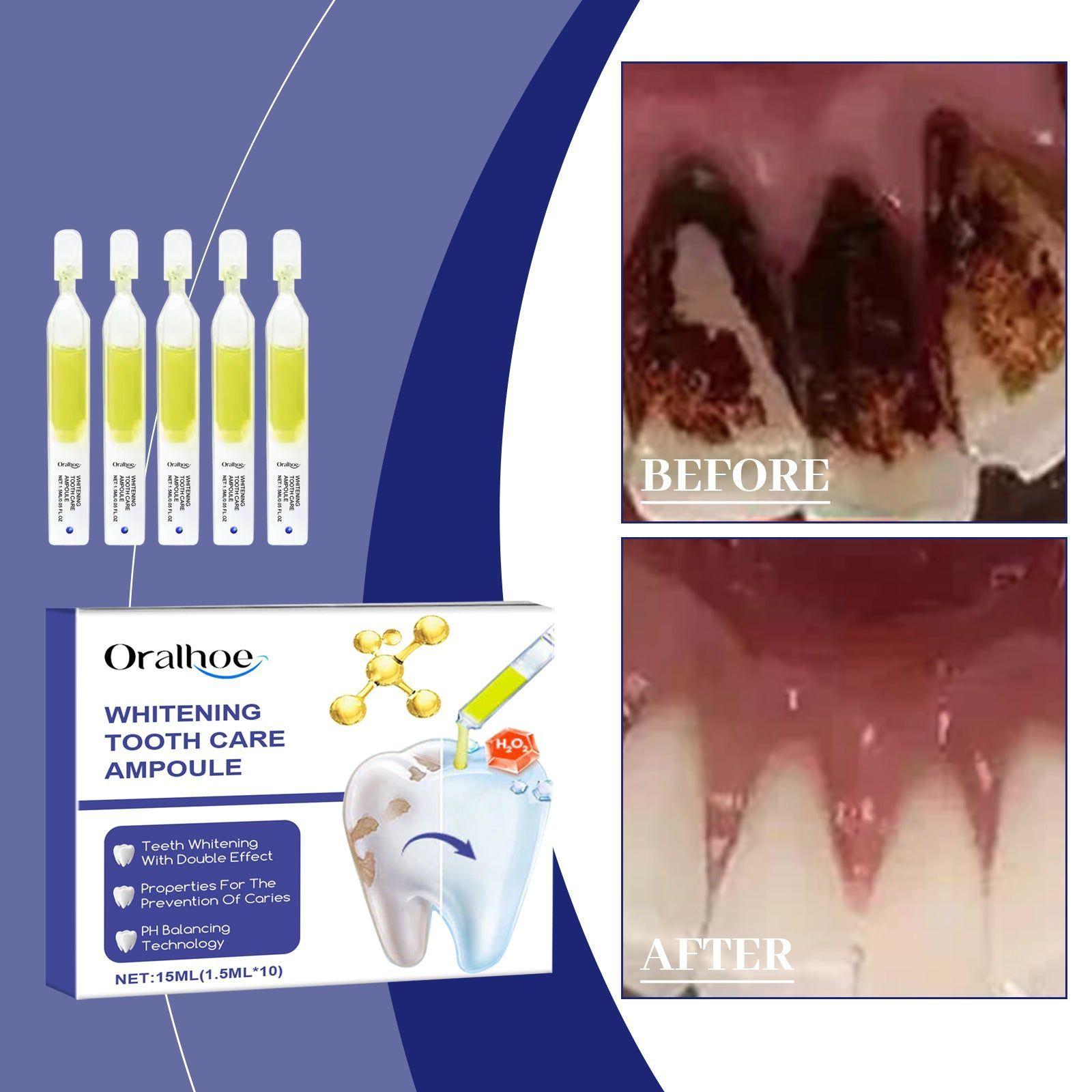 Brighten Your Smile with Teeth Whitening Serum, Remove Stains, Fresh Breath ,1.5ml*10