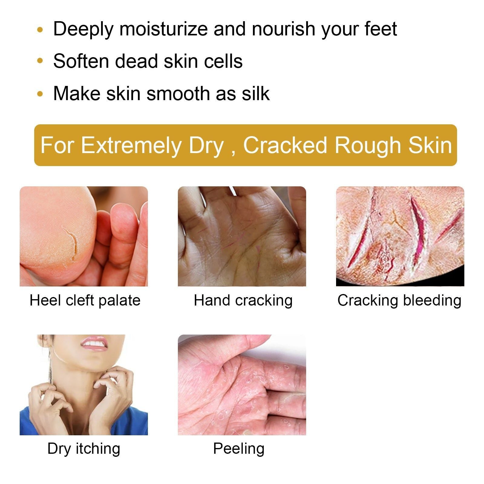 Banana Repair Cream for Dry Rough Hands Feet, Hydrating, Soothing, Anti-Cracking ,20g