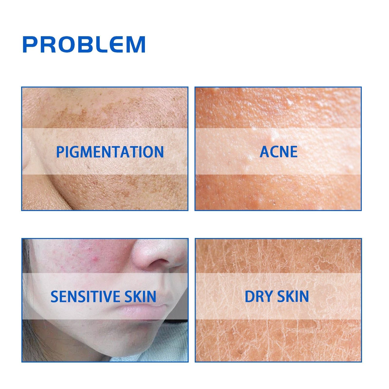 Blueberry Brightening Cream, Anti-Aging, Hydrating, Lighten Skin Tone, Wrinkle Repair ,30g
