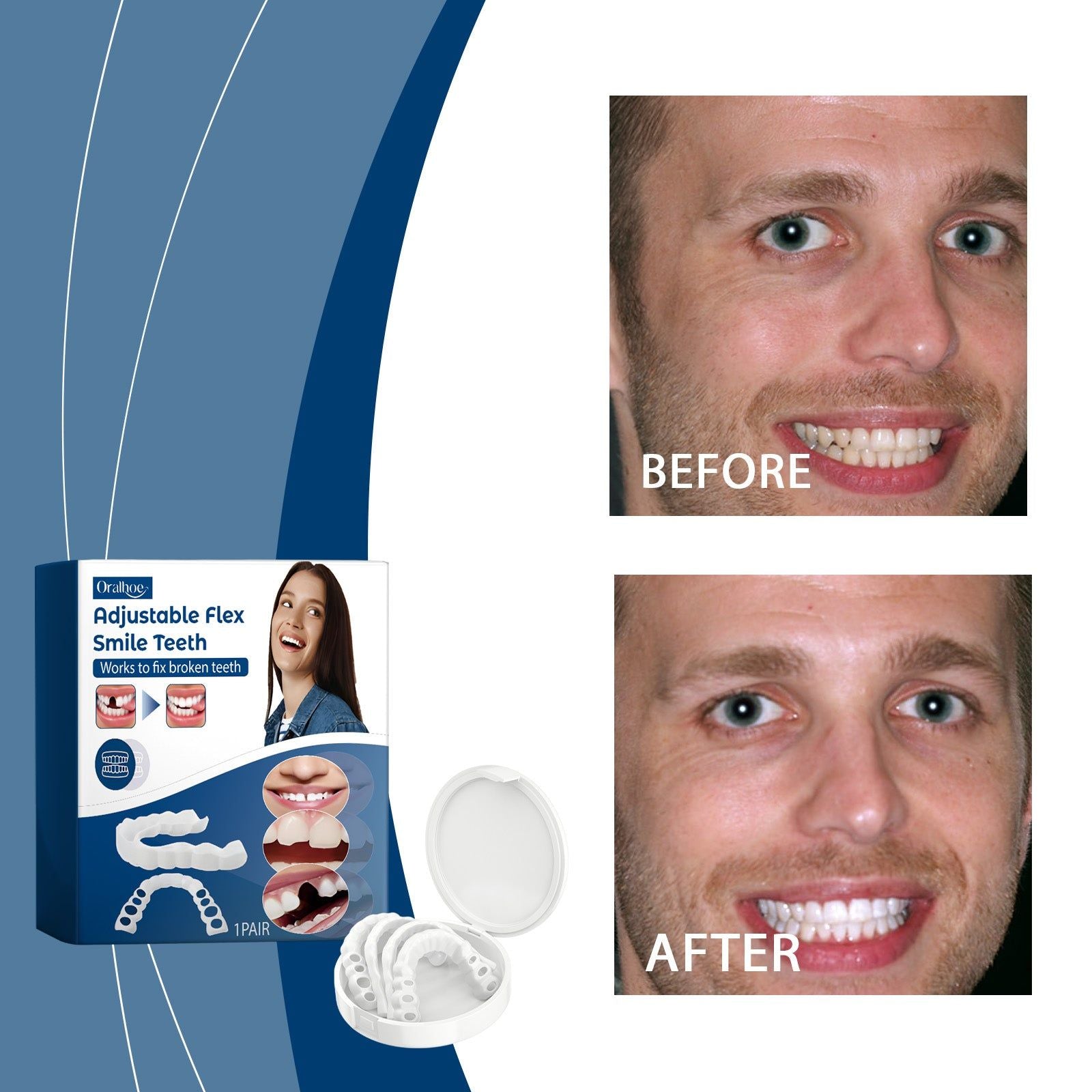 Adjustable Silicone Buckle Dentures, Instant Smile Fix, Dental Care, Comfortable Fit ,1pair